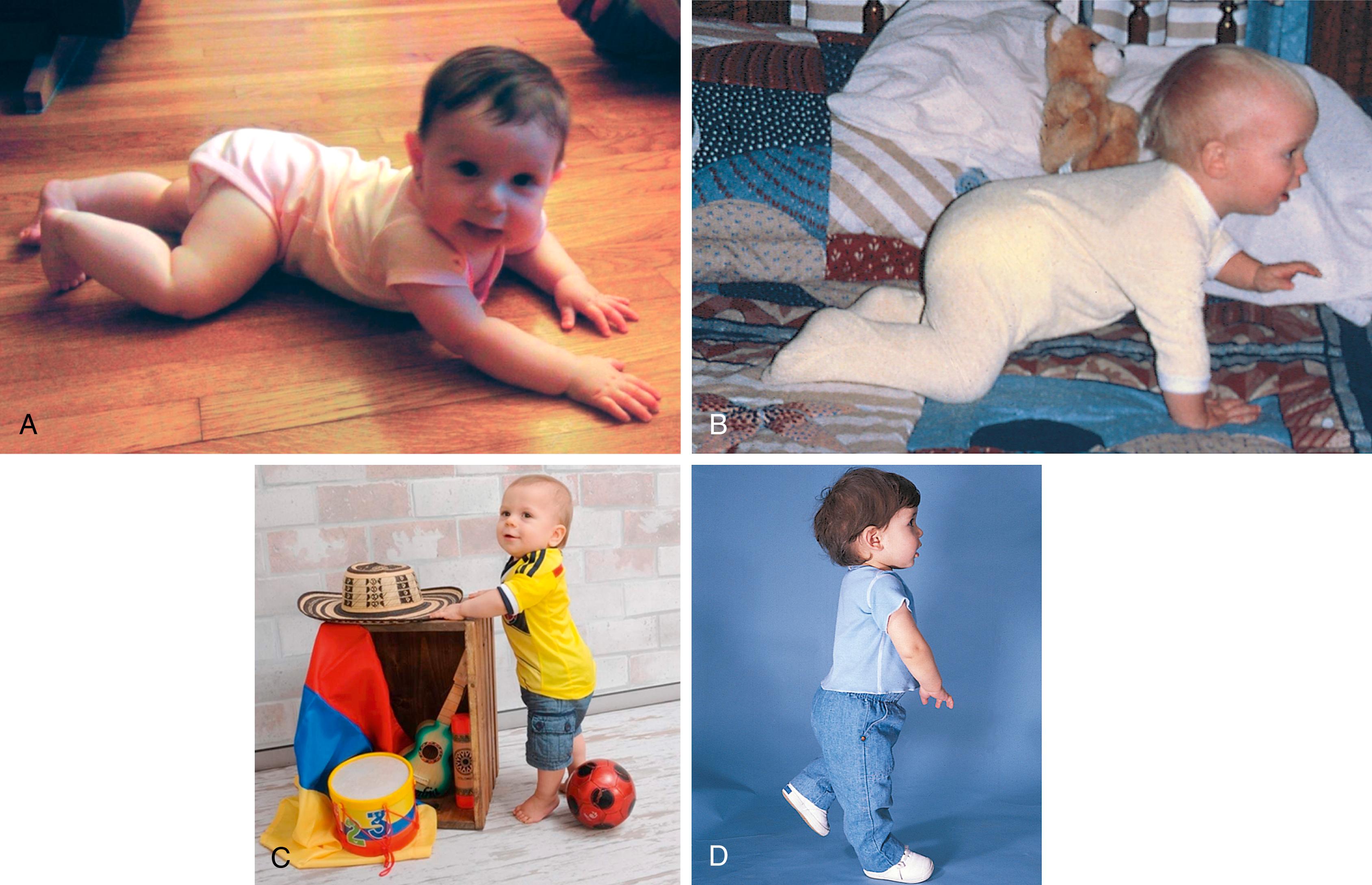 Fig. 3.10, Development of locomotion. (A) Creeping implies that the belly is still on the floor. (B) Crawling refers to mobility with the child on the hands and knees (quadruped position). (C) Cruising refers to standing with two-handed support on stationary objects before moving with steps. (D) Early free walking.