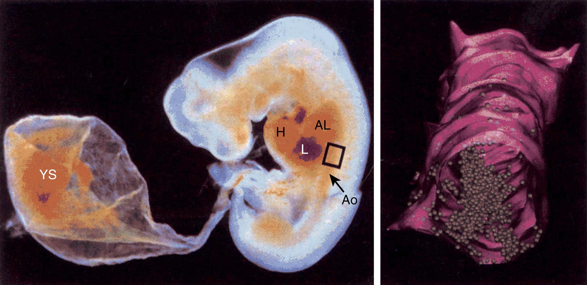 Fig. 107.2, Computer-assisted reconstruction of the dorsal aorta from a 5-week human embryo. Seventy-two 5-μm sections made in the preumbilical region (framed on the picture of the whole embryo on the left) were immunostained for CD34. The CD34 + intraaortic hematopoietic cells are in green color. AL , Anterior limn rudiment; Ao , dorsal aorta; H , heart; L , liver; YS , yolk sac.