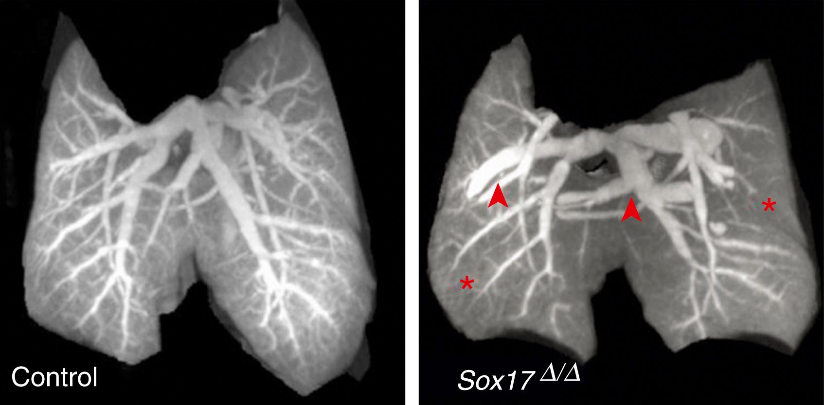 Fig. 47.11, Static 3-dimensional images of the developing pulmonary vascular network in E18.5 control and Sox17 Δ/Δ lungs showing dilated pulmonary blood vessels (arrowheads) and reduced staining of the peripheral microvasculature (asterisks).