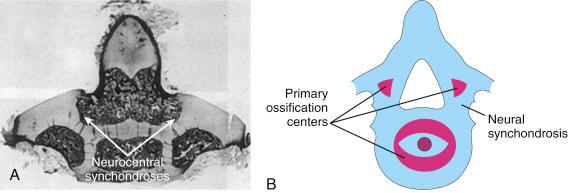 FIGURE 6-2, A, Neurocentral synchondroses of the atlas. B, Ossification centers and neurocentral synchondroses of a subaxial vertebra.