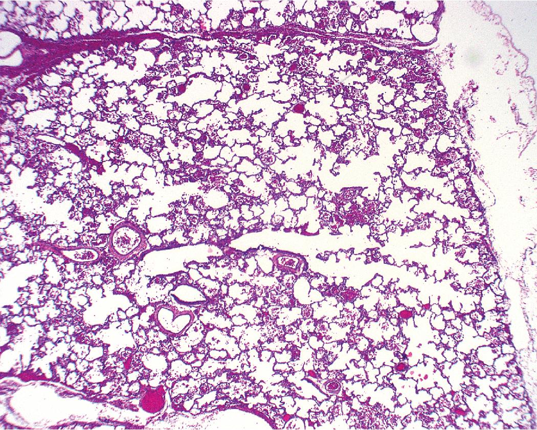 Figure 5.13, Polyalveolar lobe. An increased number of alveoli can be seen within the affected region. Radial alveolar counts can be performed to determine increased values.