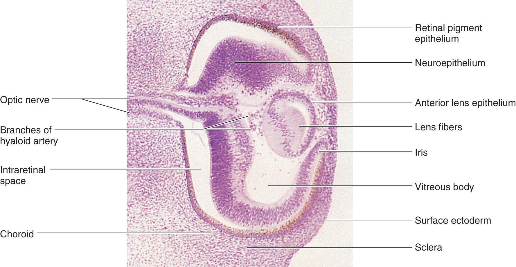 Fig. 18.4, Photomicrograph of a sagittal section of the eye of an embryo (×100) at approximately 44 days. The posterior wall of the lens vesicle forms the lens fibers. The anterior wall does not change appreciably as it becomes the anterior lens epithelium.