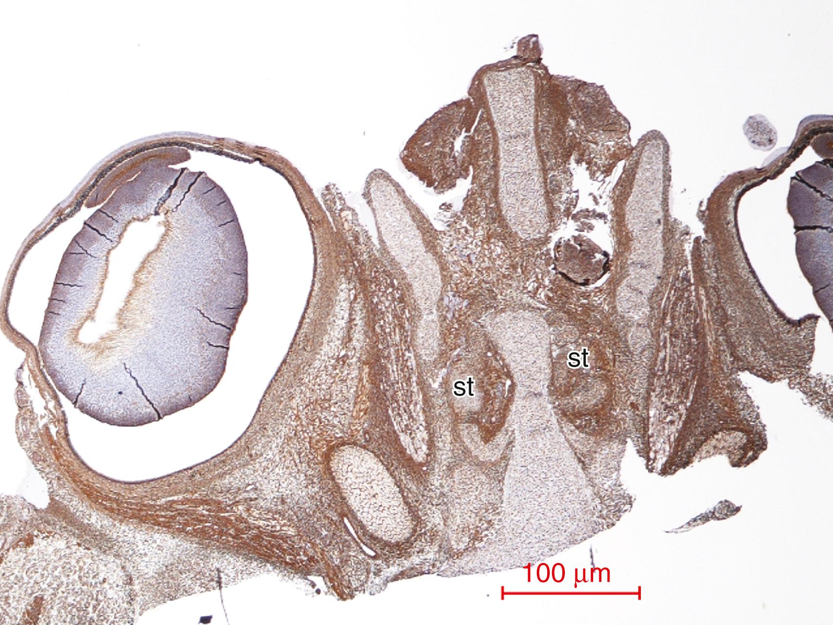 Fig. 136.2, Horizontal section through the face of a 10-week human fetus to show the cartilages forming the superior turbinate (st) bones in relation to the developing nasal cavity and orbits. These cartilages will later ossify. The olfactory epithelium extends to cover the superior and part of the middle turbinates, thus greatly increasing the area in which primary olfactory neurons can proliferate. Vimentin immunoreactivity.