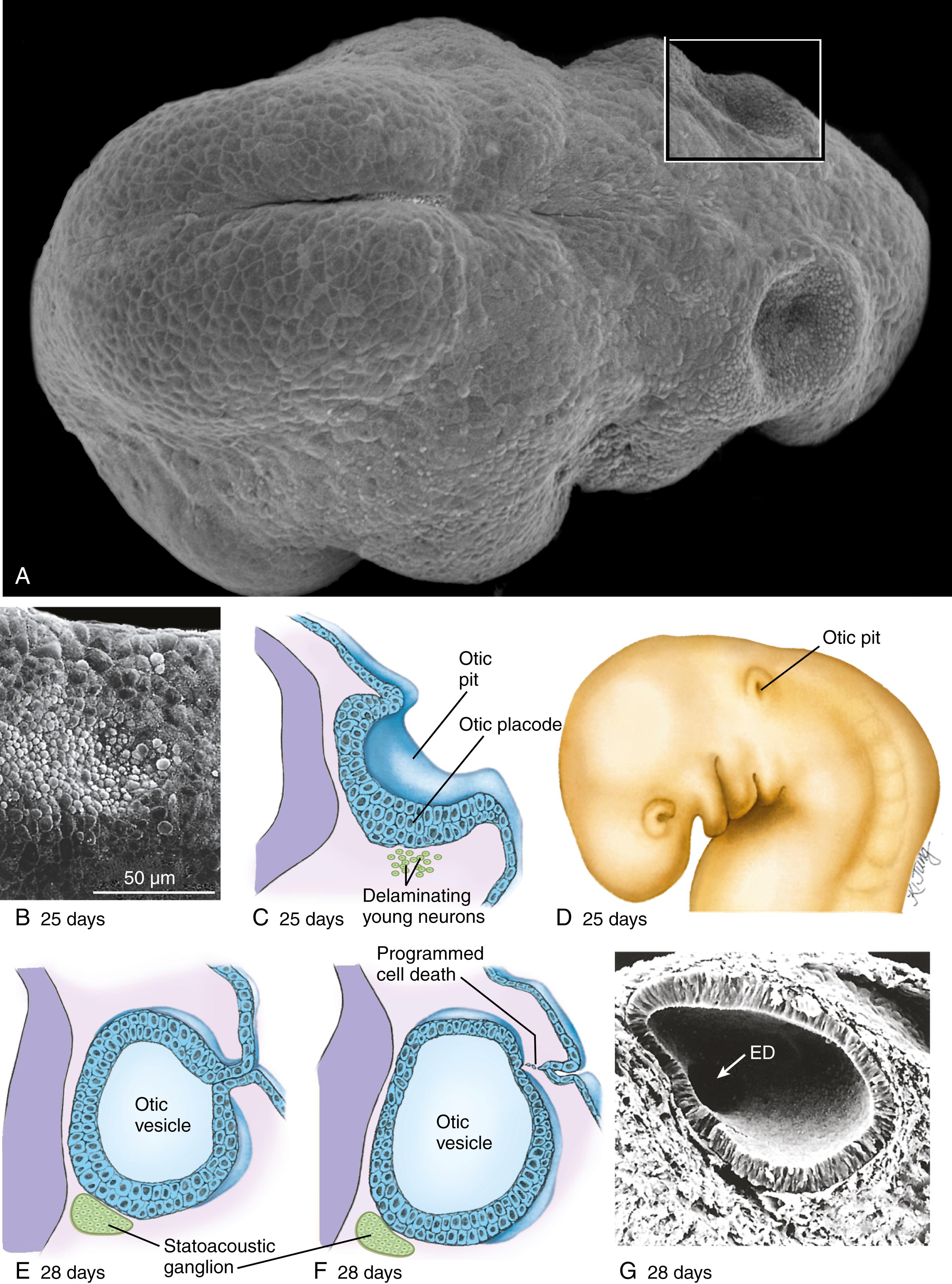 Fig. 18.2, Formation of the Otic Vesicle