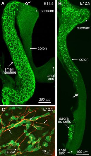Fig. 11.2, Vagal ENCCs migrate from rostral-to-caudal along the gut in close association with neurites. (A) Wholemount preparation of small intestine and colon from an E11.5 mouse processed for immunohistochemistry using antibodies against p75, which label all ENCCs. The most caudal vagal ENCC is entering the caecum (open arrow) . (B) Wholemount preparation of the colon from an E12.5 mouse in which RET-expressing ENCCs also express green fluorescent protein (GFP). The most caudal vagal ENCC is now midway along the colon (open arrow) . Sacral neural crest ( nc ) cells are present in the mesentery immediately adjacent to the distal hindgut, but have not yet entered the gut. (C) E12.5 colon in which ENCCs express GFP that has been immunostained with an antibody to neurofilament-M, which labels neurites (red; arrows) . Neurites are in close association with most ENCCs.