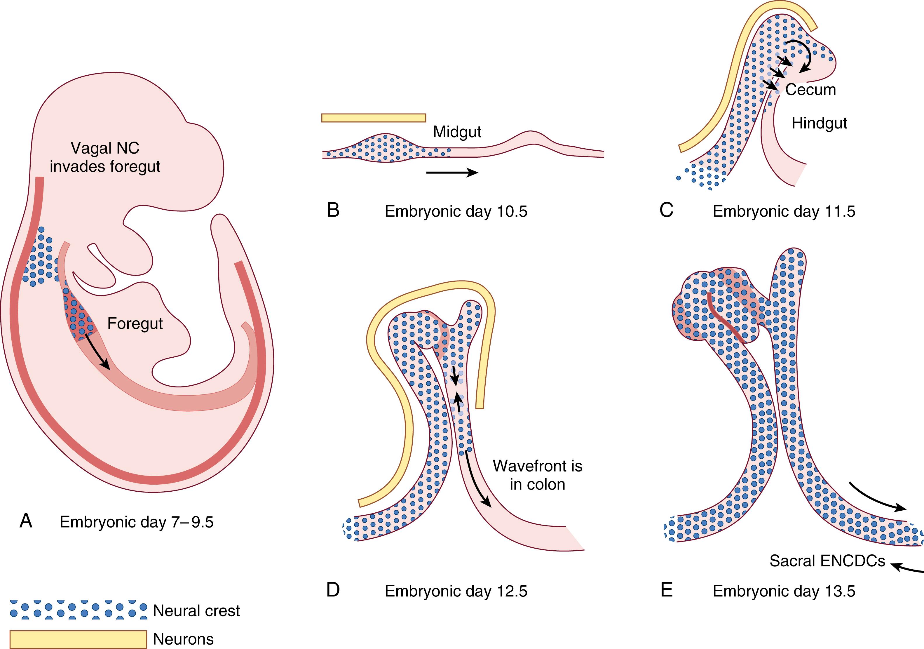 Fig. 84.2, Development of the murine enteric nervous system. (A) Vagal preenteric neural crest–derived cells enter the foregut and begin to migrate through the bowel. (B–E) Pre-enteric neural crest-derived cells migrate rostrocaudally and begin to differentiate into neurons and glial cells as the bowel lengthens and changes shape.