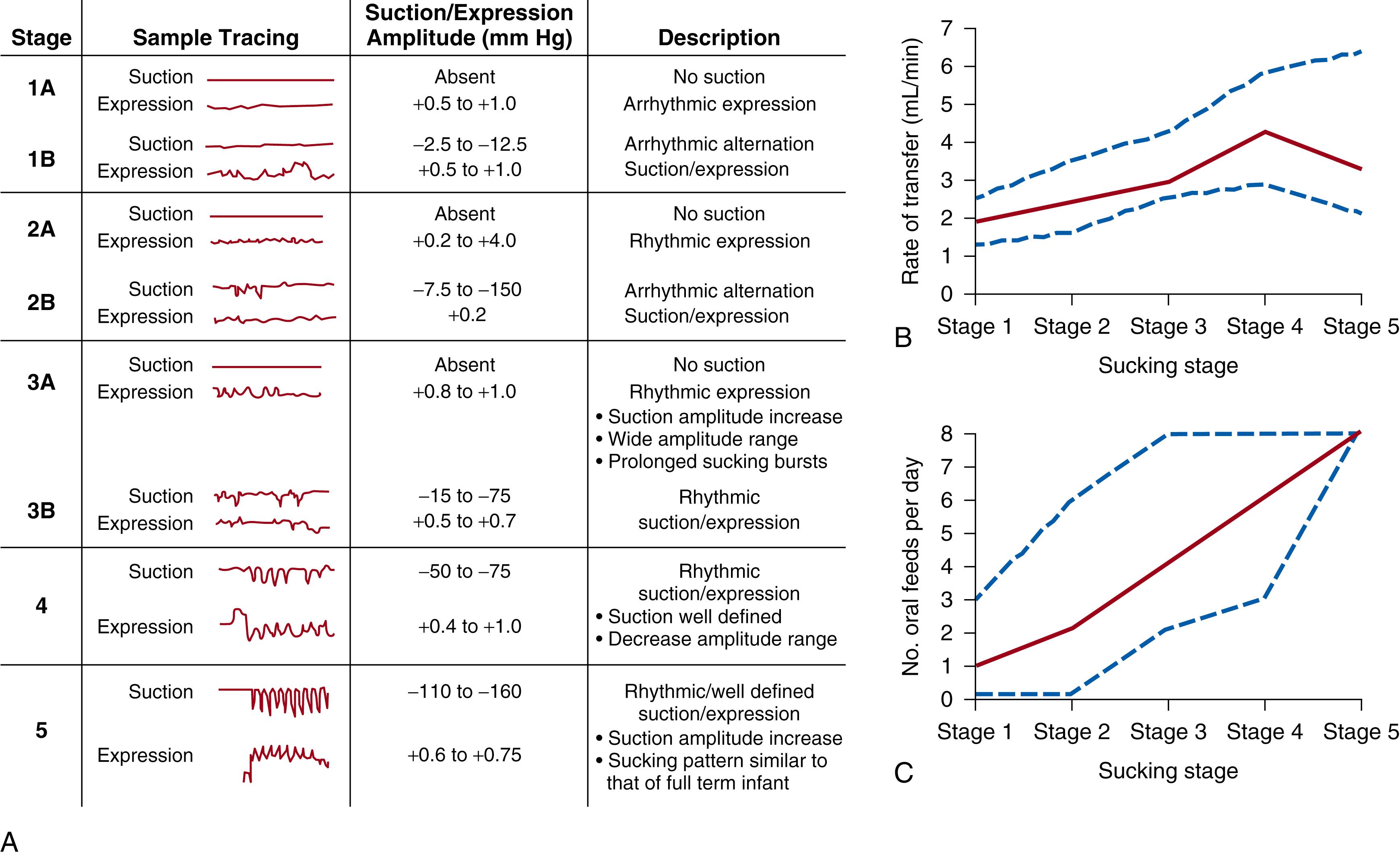 Fig. 84.5, (A) Stages of sucking characterized in preterm infants. (B) Rate of milk transfer during feeding in infants at the different stages of sucking. (C) Number of feedings per day at different stages of sucking. Data are shown as the median, with dashed lines indicating the interquartile range.