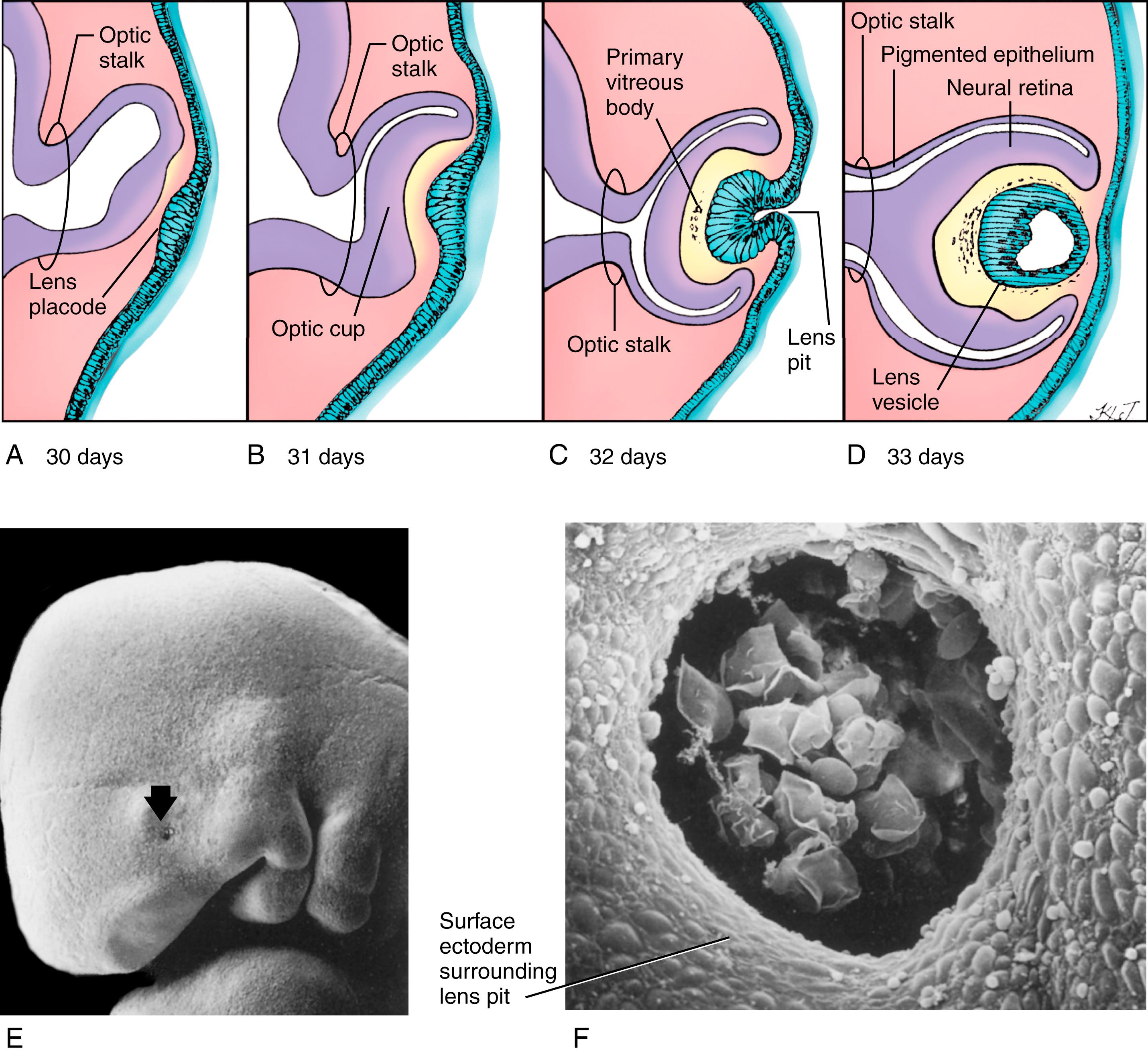 Fig. 19.3, Formation of the Lens Placode, Pit, and Vesicle