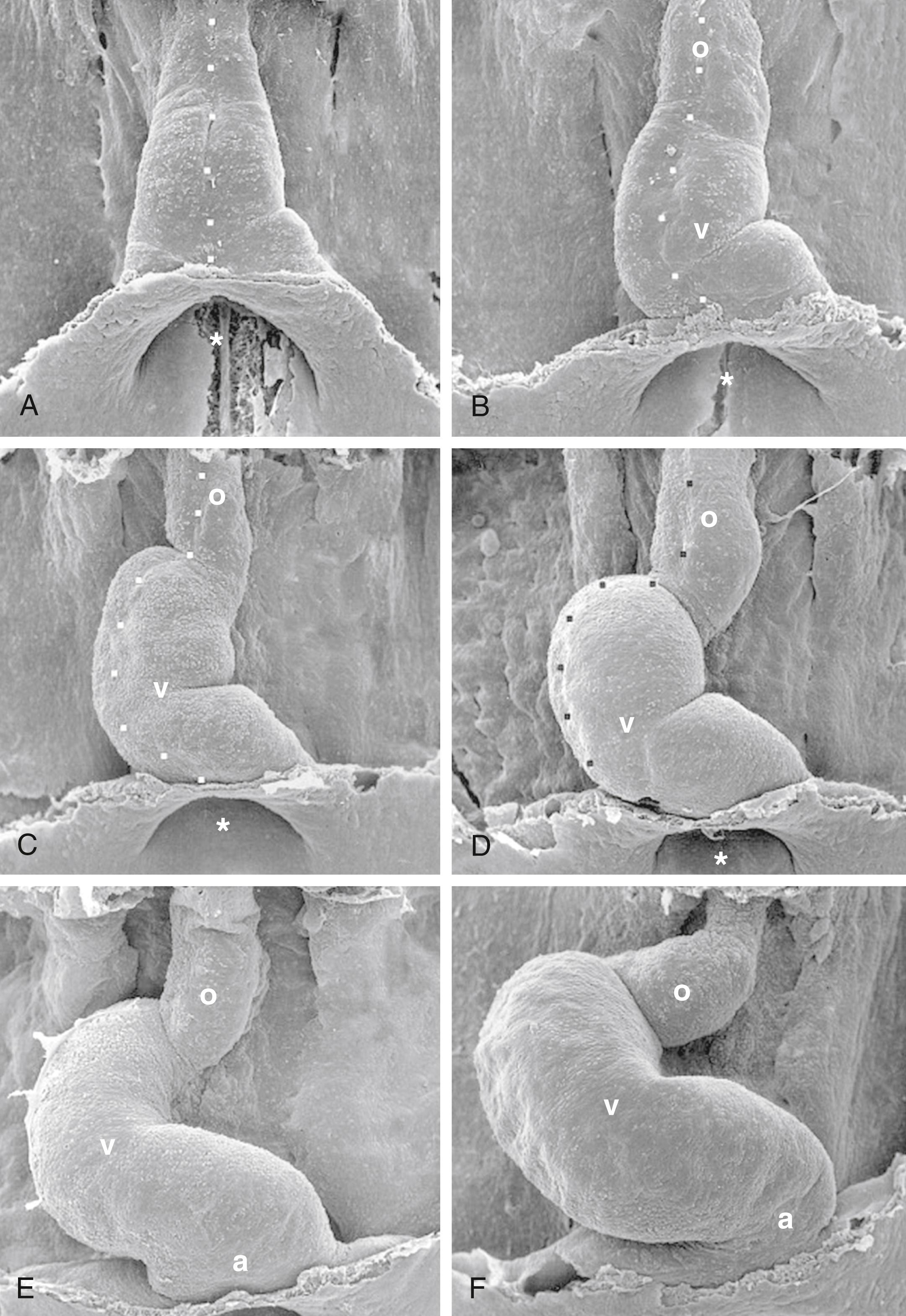 Fig. 12.13, Scanning Electron Micrographs Showing Looping of the Chick Heart Tube in Ventral Views (Endoderm Has Been Removed)