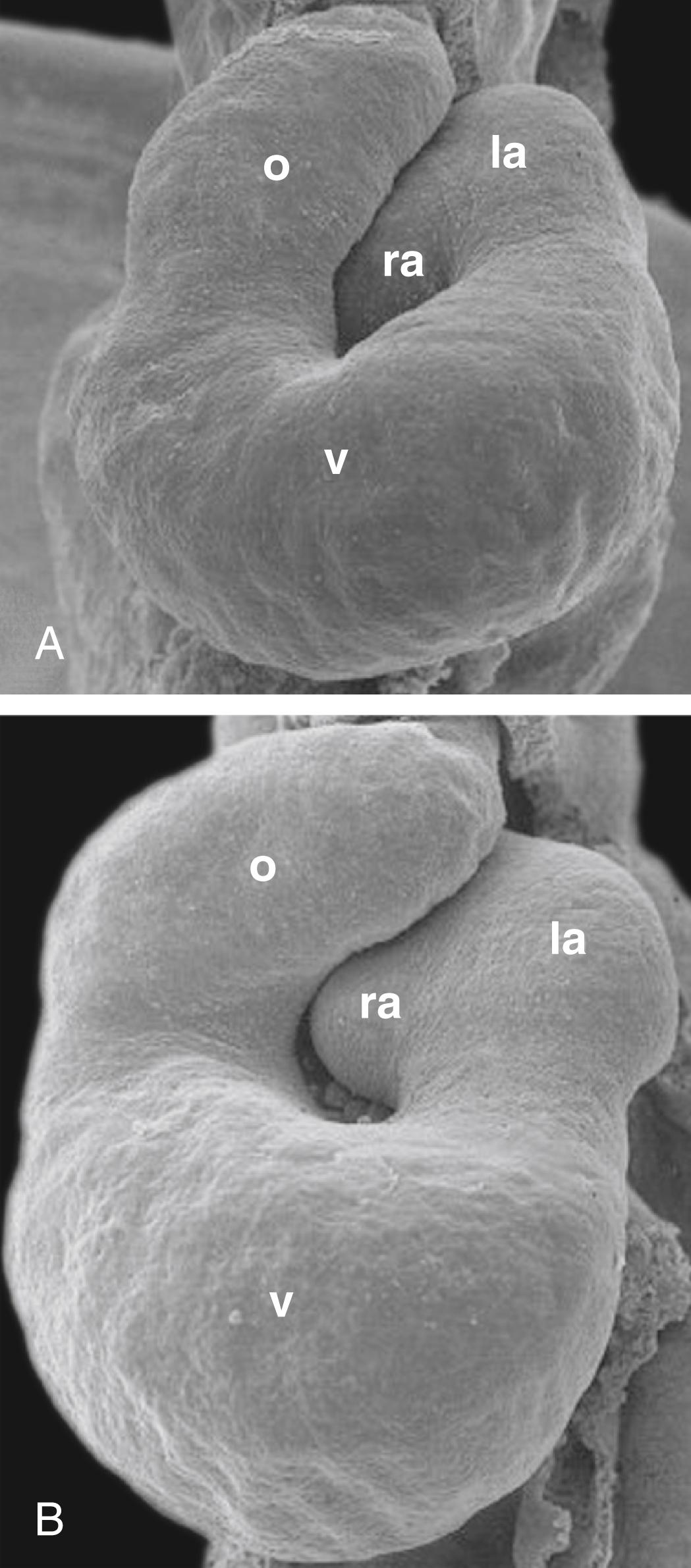 Fig. 12.14, Scanning Electron Micrographs Showing Late Views of Looping of the Chick Heart Tube