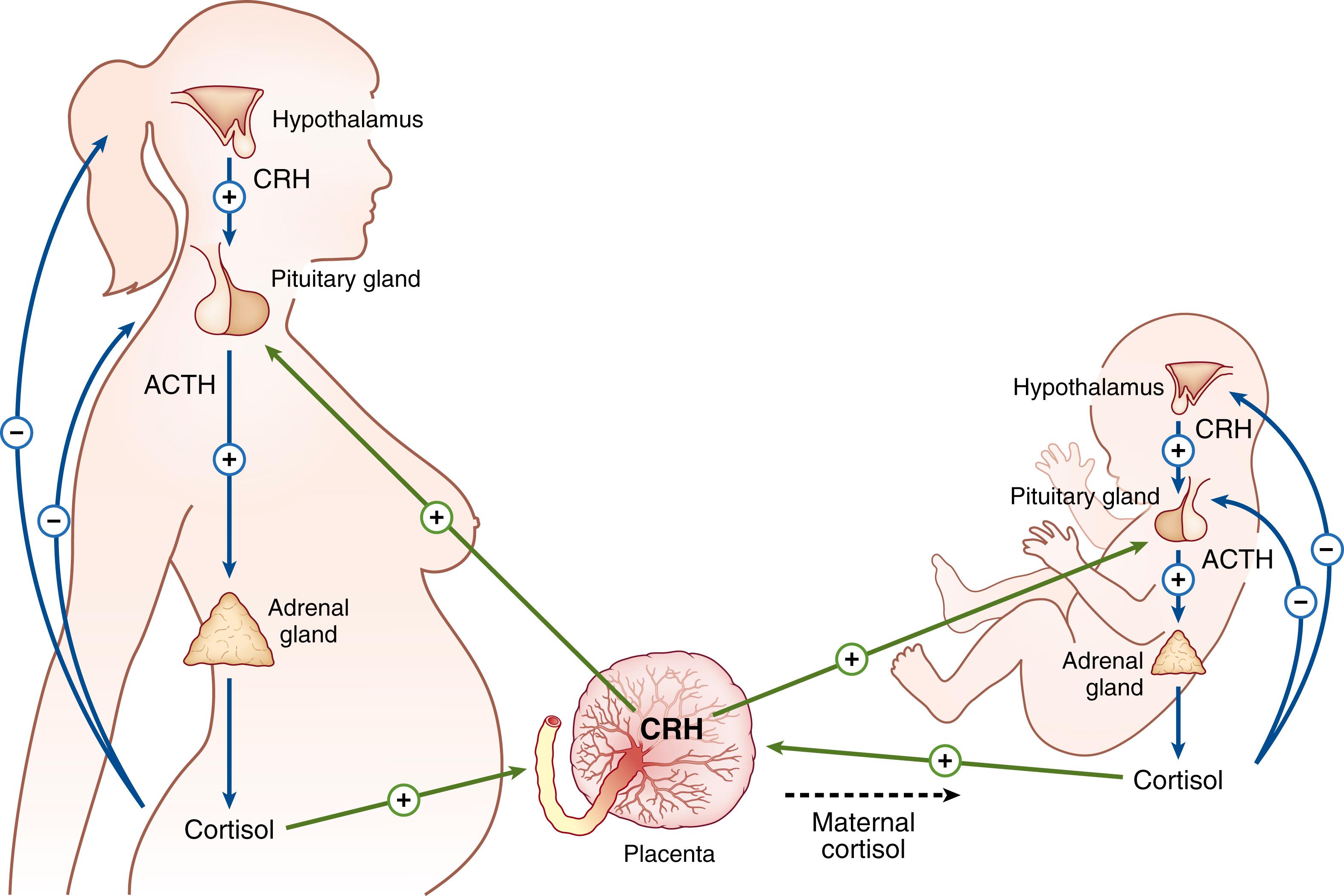 Fig. 143.1, Influence of placental corticotropin-releasing hormone (CRH) on both the maternal and fetal hypothalamus-pituitary-adrenal axes. ACTH , Adrenocorticotropic hormone.