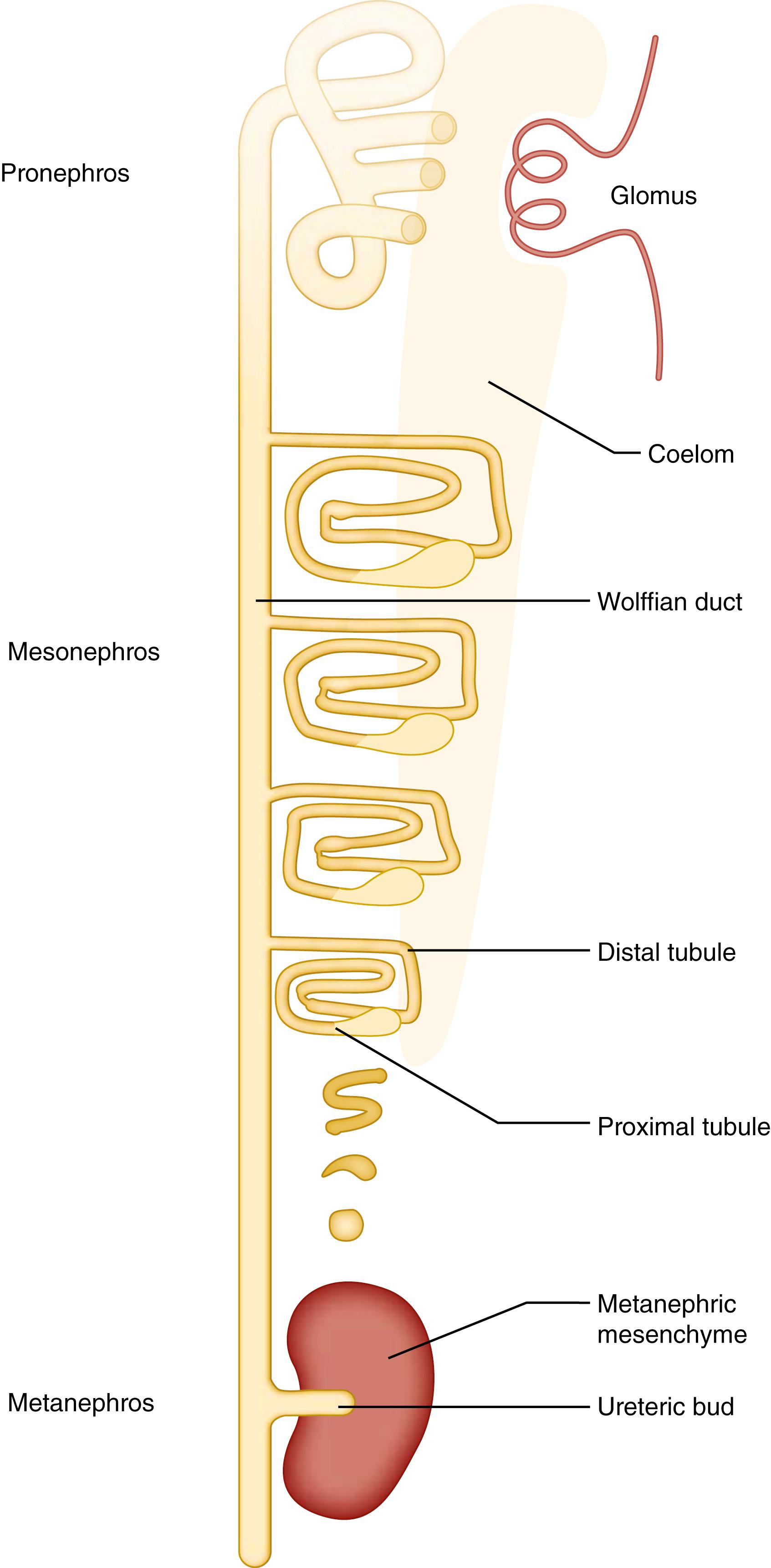 Fig. 93.1, Schematic representation showing development of the pronephros, mesonephros, and metanephros. The pronephros, composed of a single glomus, projects into the nephrocoel but filters directly into the coelom and is depicted as having already degenerated. The mesonephros consists of multiple nephrons that develop in a cranial to caudal fashion such that the most caudal structures are still in the process of developing into complete nephrons that will attach to the wolffian duct. The metanephros at this stage comprises the ureteric bud, which has entered the metanephric mesenchyme but has not yet branched.