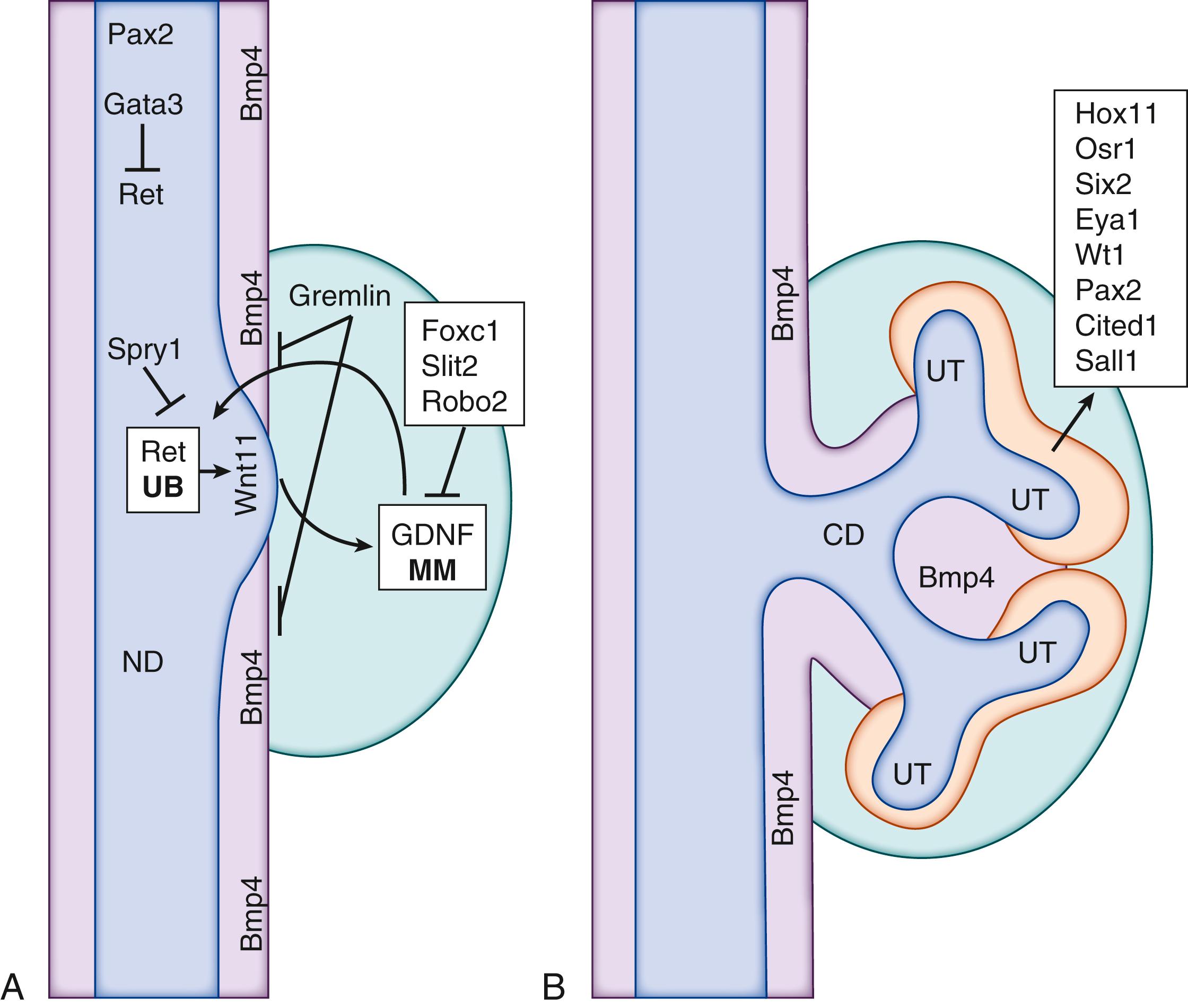 Fig. 93.2, (A) Schematic diagram illustrating key genes expressed in the nephric duct (ND, blue ) and metanephric mesenchyme (MM, green ) that regulate ureteric budding. Note that Bmp4 is expressed in a sleeve of tissue (purple) that surrounds the ND. (B) The earliest stages of ureteric branching morphogenesis. Note that the field of Bmp4 expression (purple) is now extended and prevents ectopic branching events. Genes expressed by the cap mesenchyme (orange) are shown. CD, Collecting duct; GDNF, glial cell–derived neurotrophic factor; UT, ureteric tree.