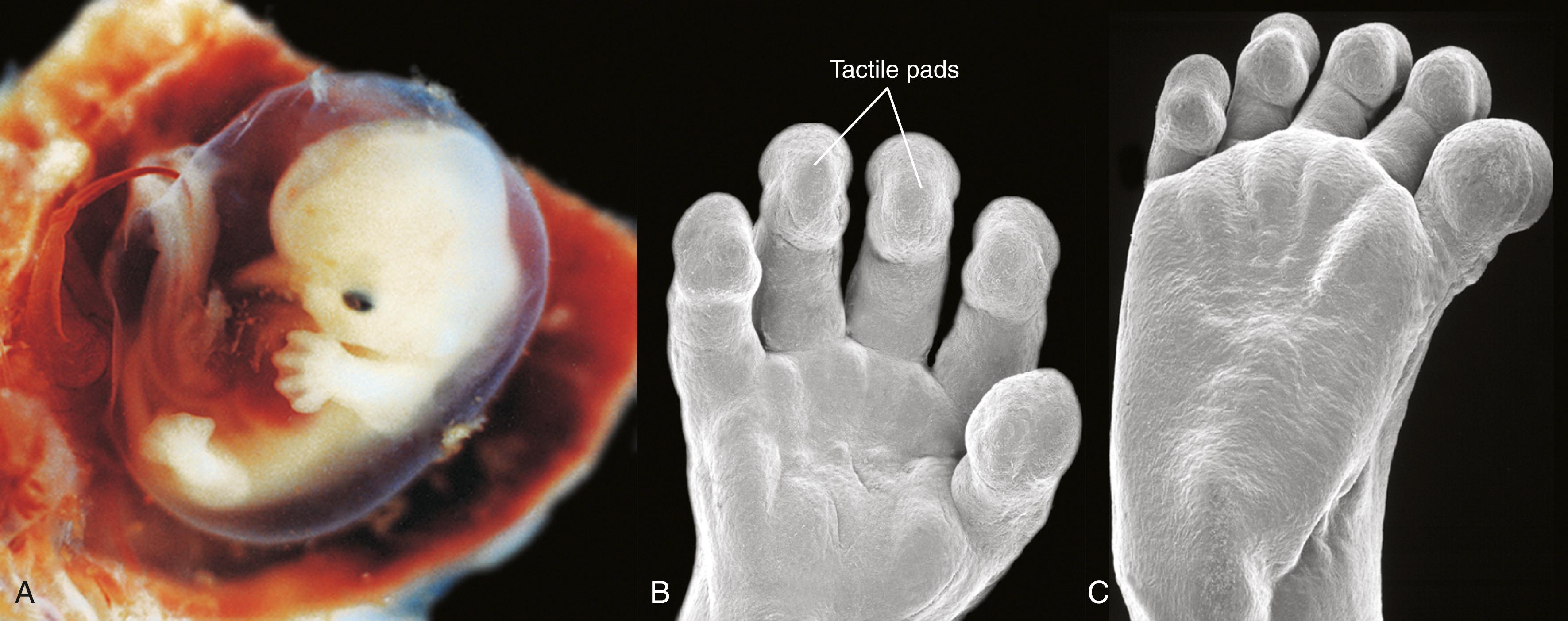 Fig. 20.12, Human Limbs During Early Development