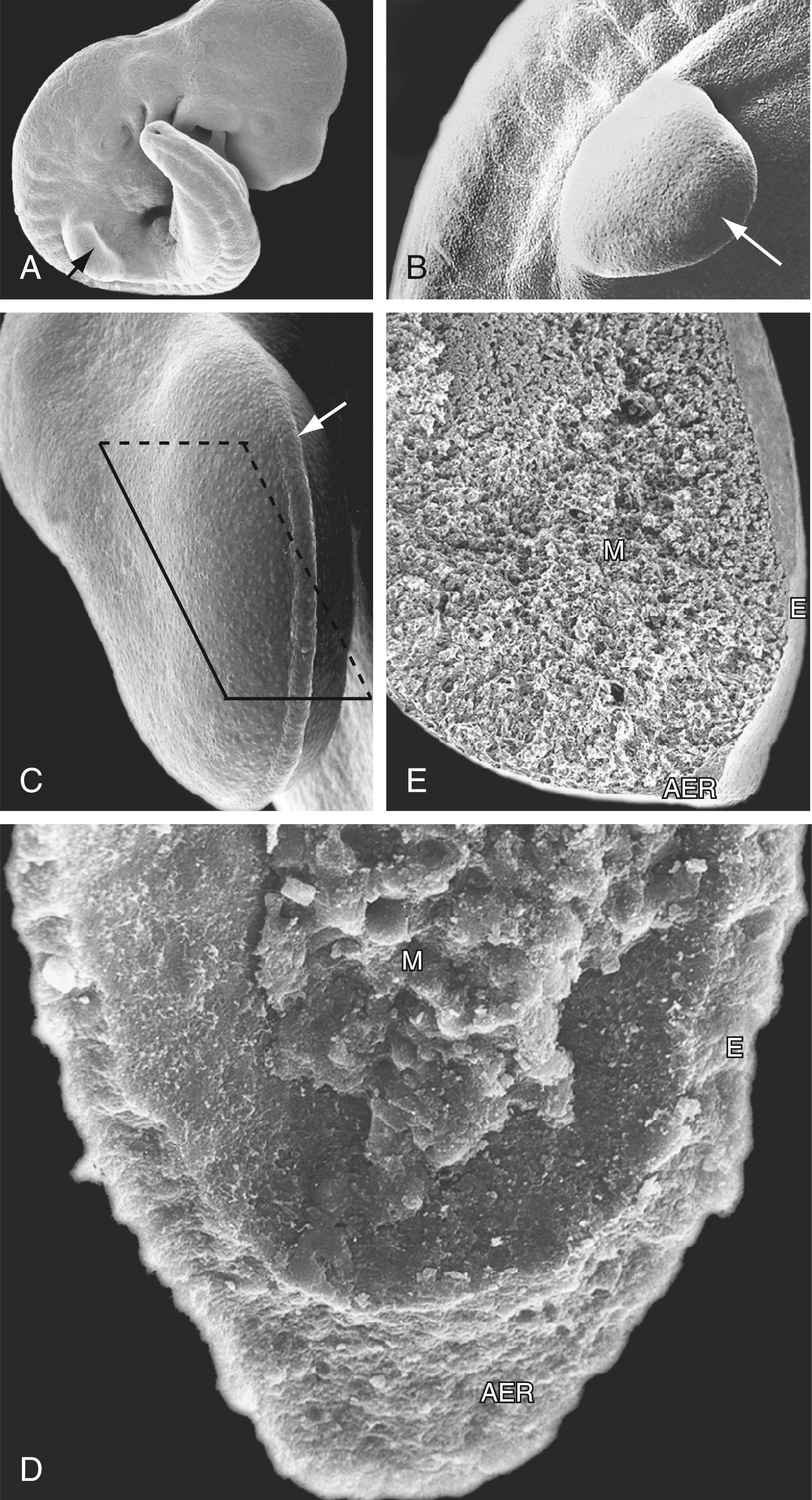 Fig. 20.2, Scanning Electron Micrographs Showing Limb Buds