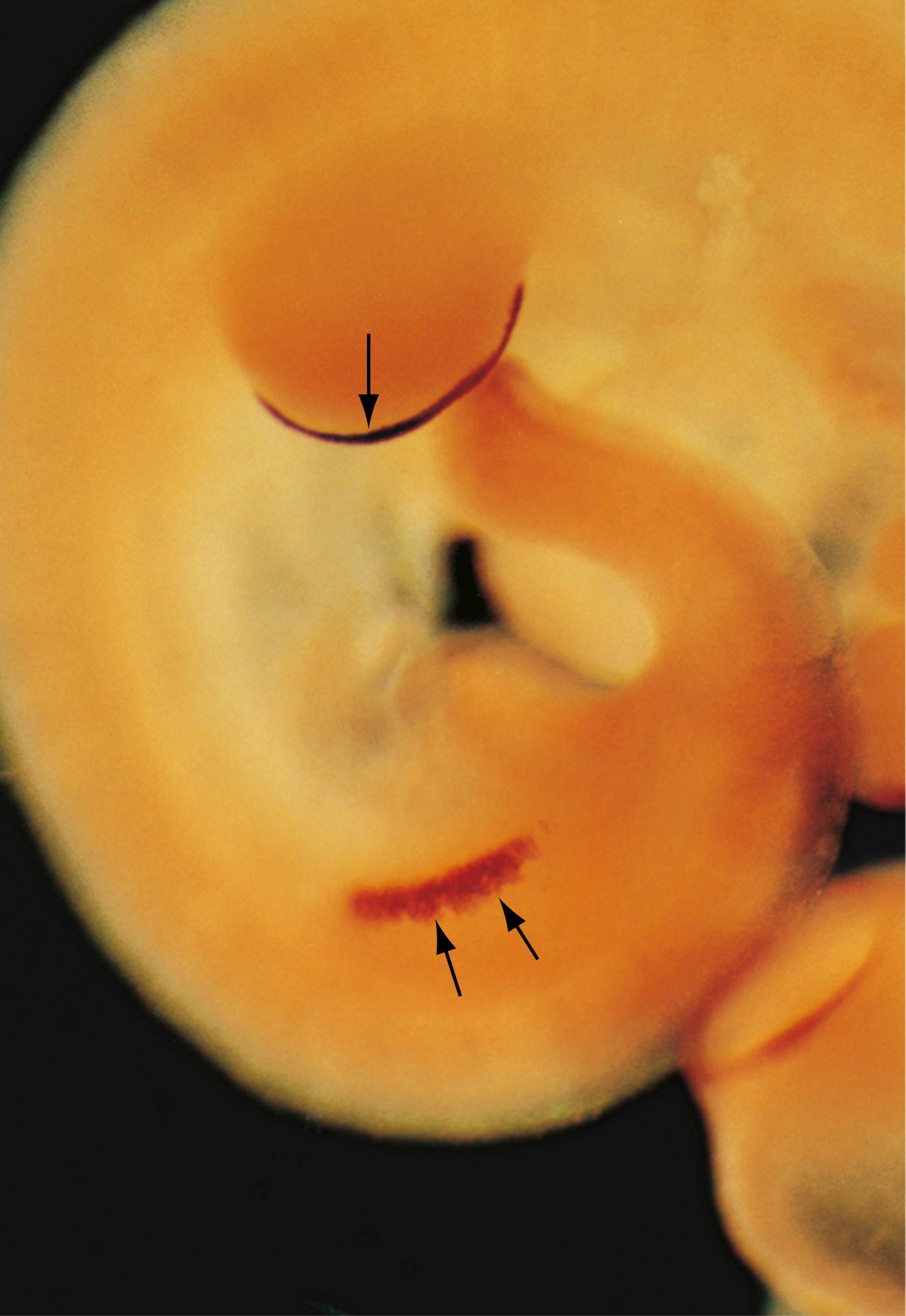 Fig. 20.5, I n Situ Hybridization Showing that mRNA Transcripts for Fgf8 are Expressed in the Ectoderm Before Limb Bud Outgrowth (Two Arrows Mark Expression in the Hindlimb Region Near the Bottom of the Photograph) and Then Become Discretely Contained Within the Apical Ectodermal Ridge (Single Arrow) During Later Development The development of the forelimb bud is advanced with respect to that of the hindlimb bud. (See Figure Credits.)