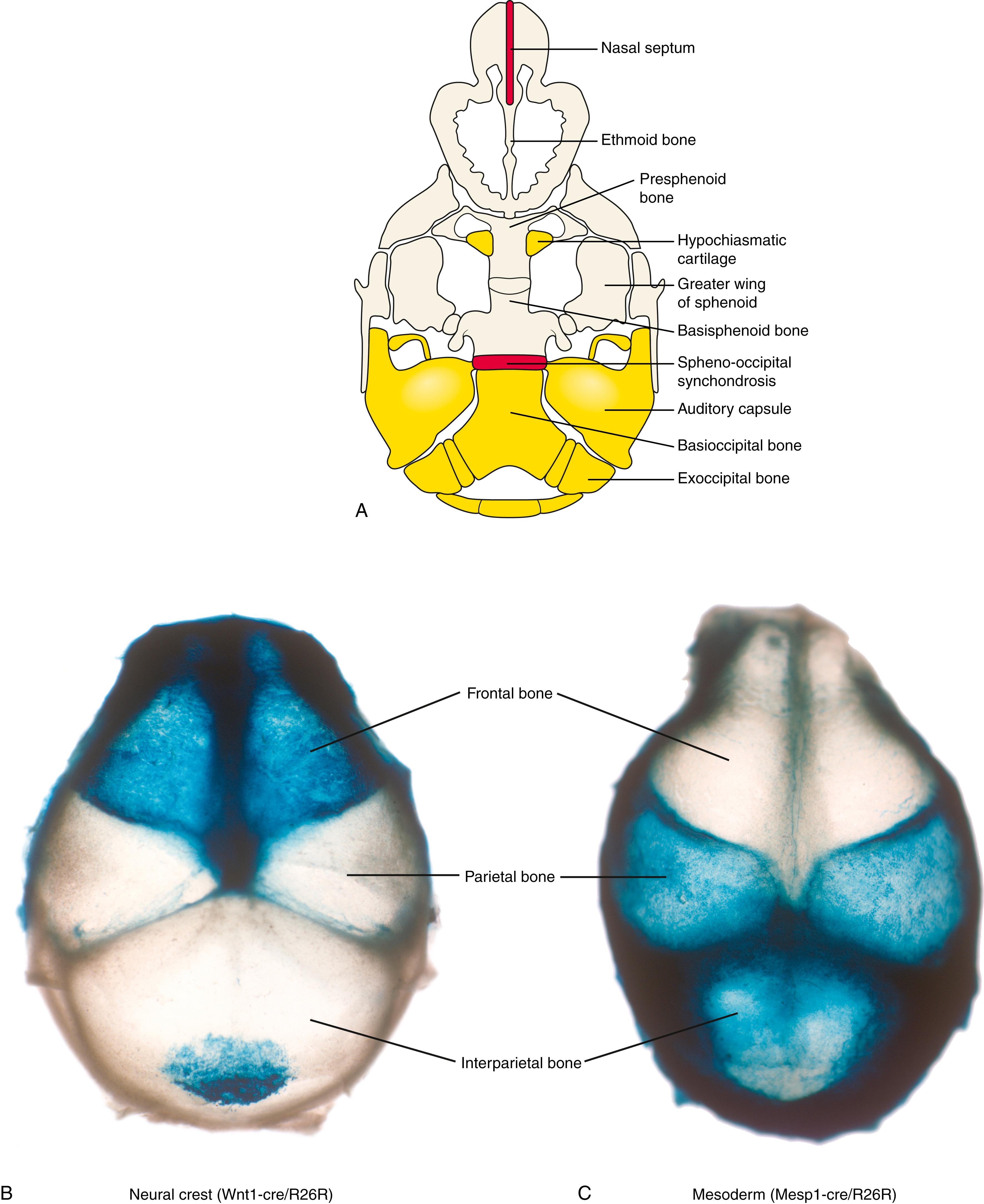 Fig. 17.4, Developmental Origins of the Bones of the Skull