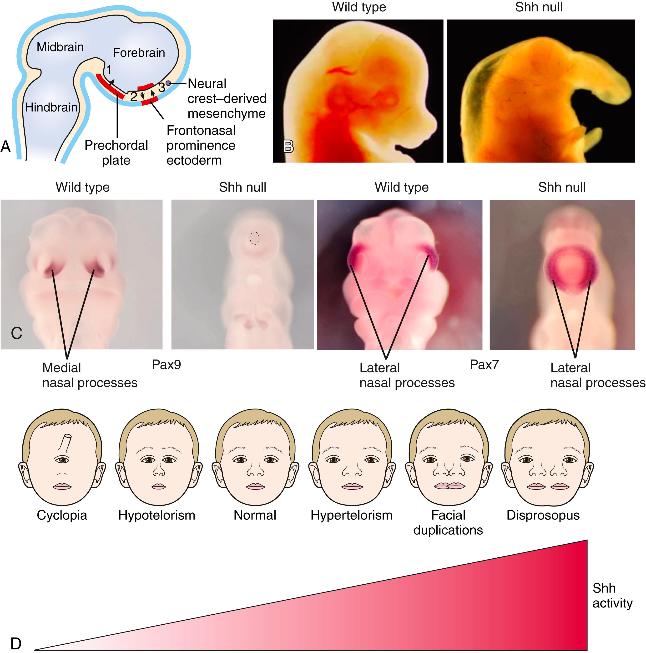 Fig. 17.8, The Role of Shh During Establishment of the Midline