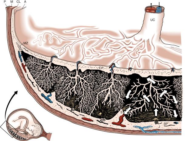 • Fig. 7.1, A nearly mature human placenta in situ. On the fetal side, the amnion (A) covers the chorionic plate (CP), from which the umbilical cord (UC) continues towards the fetus. From the CP, the villous trees extend into the intervillous space (IVS), which is filled with maternal blood. On the maternal side, the basal plate (BP) demarcates the placenta from the placental bed, which defines that part of the uterine wall directly underneath the placenta. Within the placental bed, trophoblast invasion takes place, and transformation of spiral arteries can be found. At the margin of the placenta, the CP and BP fuse to circumvent the IVS and to generate the fetal membranes. CL, chorion laeve; J, junctional zone; M, myometrium; MZ, marginal zone between placenta and fetal membranes, with obliterated intervillous space and ghost villi; P, serosa; S, septum.