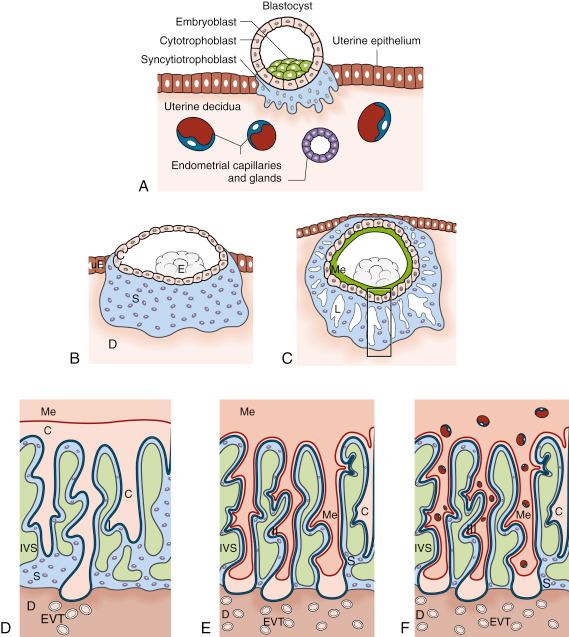 • Fig. 7.2, Early placental development. A, The blastocyst is covered by a monolayer of trophoblast cells that encircle a fluid-filled cavity, the blastocoel, and the developing embryoblast. A crucial developmental prerequisite for implantation is a next differentiation step of those trophoblast cells in direct contact to the uterine epithelium. Only syncytial fusion of these cells to develop a first syncytiotrophoblast enables the blastocyst to penetrate the uterine epithelium and to further implant into the maternal uterine tissues.