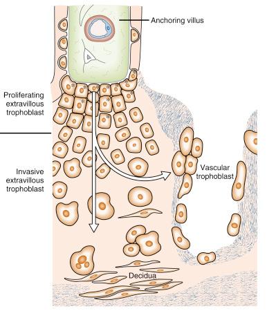 • Fig. 7.3, Trophoblastic cell column. Schematic drawing of a trophoblastic cell column connecting a villous stem (above) to the basal plate (below) . Proliferating stem cells (asterisk) of the extravillous trophoblast. The arrow symbolises the invasive pathway. Fibrin-type fibrinoid (line shading) . Extracellular matrix (light point shading) .