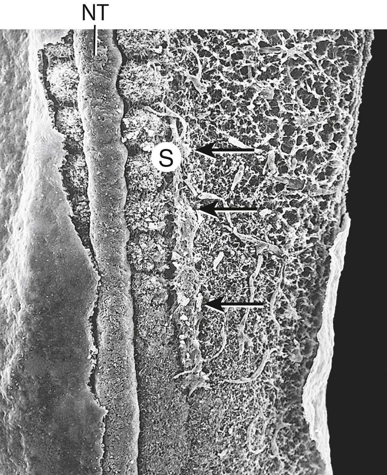 Fig. 15.3, Formation of the Mesonephric Duct