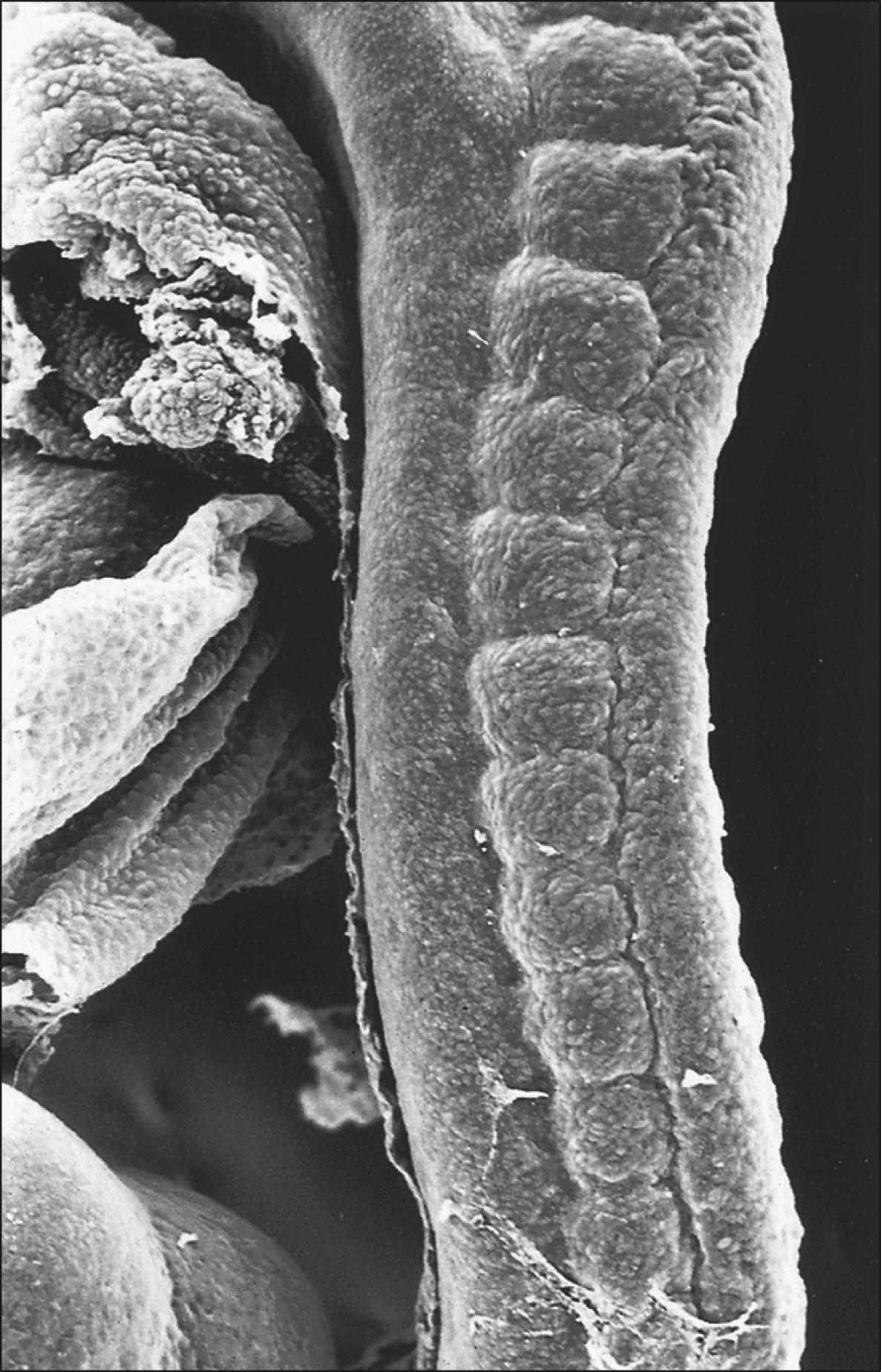 Fig. 18.1, A scanning electron micrograph of a lateral view of an embryo, showing the somites. The cranial somites are at the upper border and the more caudal somites are at the lower border. Note the change in size of the cranially more advanced somites.