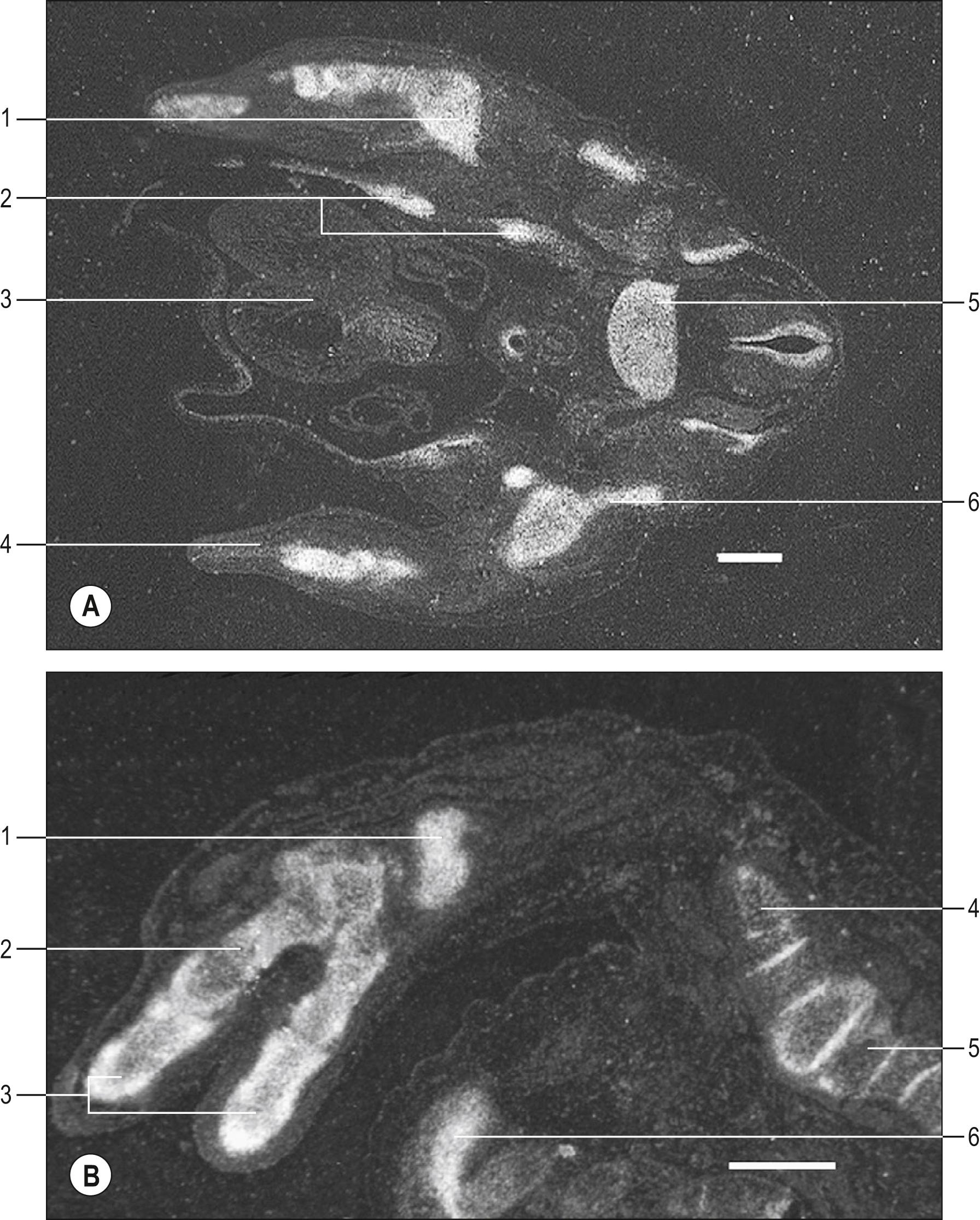 Fig. 19.4, Sox9 expression in the skeleton of developing limbs of human embryos. A , Stage 18; Key: 1, humerus; 2, ribs; 3, heart; 4, forearm; 5, vertebral body; 6, scapula. B , Stage 21; Key: 1, carpal; 2, metacarpal; 3, phalanges; 4, humerus; 5, scapula; 6, rib. Sox9 transcripts are detected in sections with radioactively labelled probes followed by autoradiography. Positive signal is represented by silver grains that show up as white areas. Scale bars represent 500 μm in both A and B .