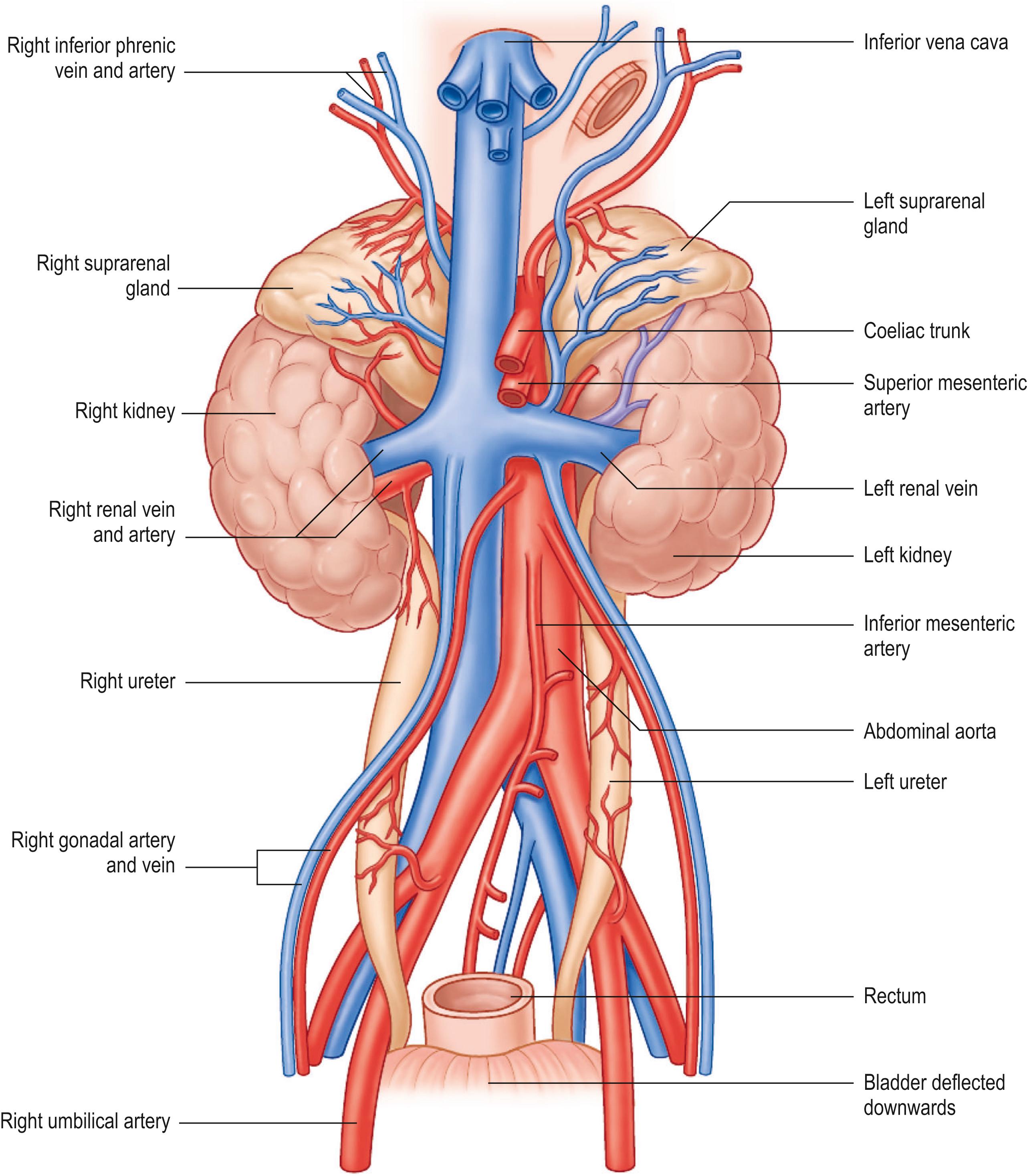 Fig. 22.8, The posterior abdominal wall of a full-term neonate. Note the lobulated kidneys and relatively wide calibre of the ureters.