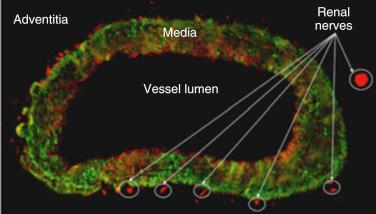 Fig. 43.3, Cross-sectional histology revealing the adventitial location of renal nerves.