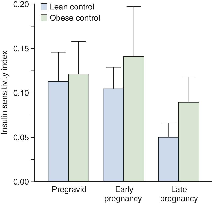 Fig. 45.6, Longitudinal changes in the insulin sensitivity index (glucose infusion rate adjusted for residual endogenous glucose production and insulin concentrations achieved during the glucose clamp) in lean and obese women with normal glucose tolerance: pregravid and early and late gestation.