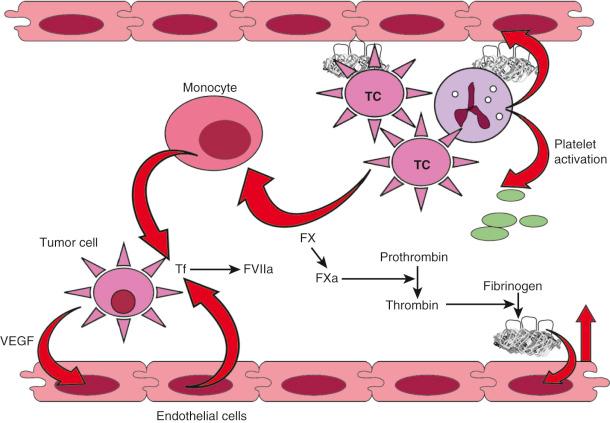 Figure 33.2, Molecular mechanism underlying venous thromboembolism (VTE) in cancer. Tissue factor expressed on the surface of cancer cells activates factor VII, thereby triggering coagulation. Fibrin enhances angiogenic interleukin (IL)-8 expression by endothelial cells. Endothelial cells further express tissue factor, which will help to maintain activated coagulation. Vascular endothelial growth factor (VEGF) expression by tumor cells (TCs) will favor angiogenesis. Activation of neutrophils by tumor cells will activate the procoagulant and adhesive properties of platelets and endothelial cells. Activation of monocytes by cancer cells induces coagulation through the expression of tissue factor. (From Davis et al. Supportive Oncology. Saunders; 2011, Figure 26-1 )