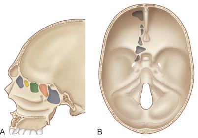 Fig. 1.6.1, Lateral (A) and basal (B) views of the skull illustrating the anatomy of the paranasal air sinuses.