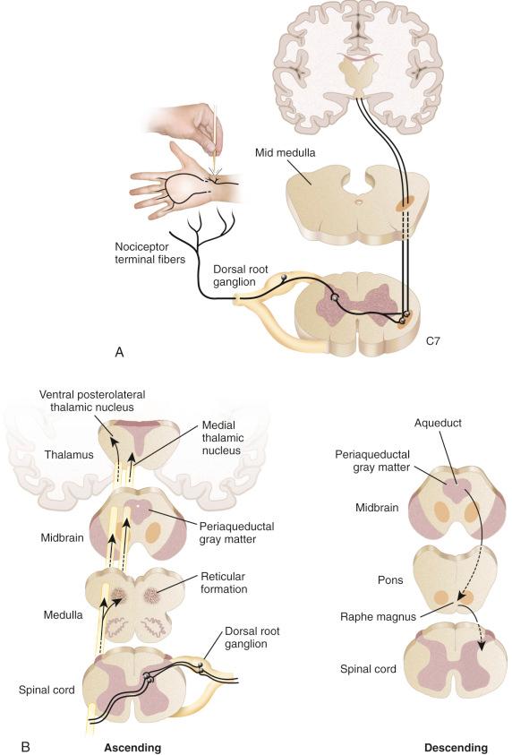 FIG 40-5, A, How peripheral nociceptive information is relayed by the peripheral nerve through the dorsal root ganglia to the dorsal horn of the spinal cord and then via contralateral ascending spinal tracks to the brainstem and cortex. B, How pain signals are modulated by descending pathways after processing in the core.