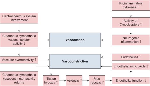 FIG 40-8, Mechanisms involved in vasomotor disturbances in complex regional pain syndrome.