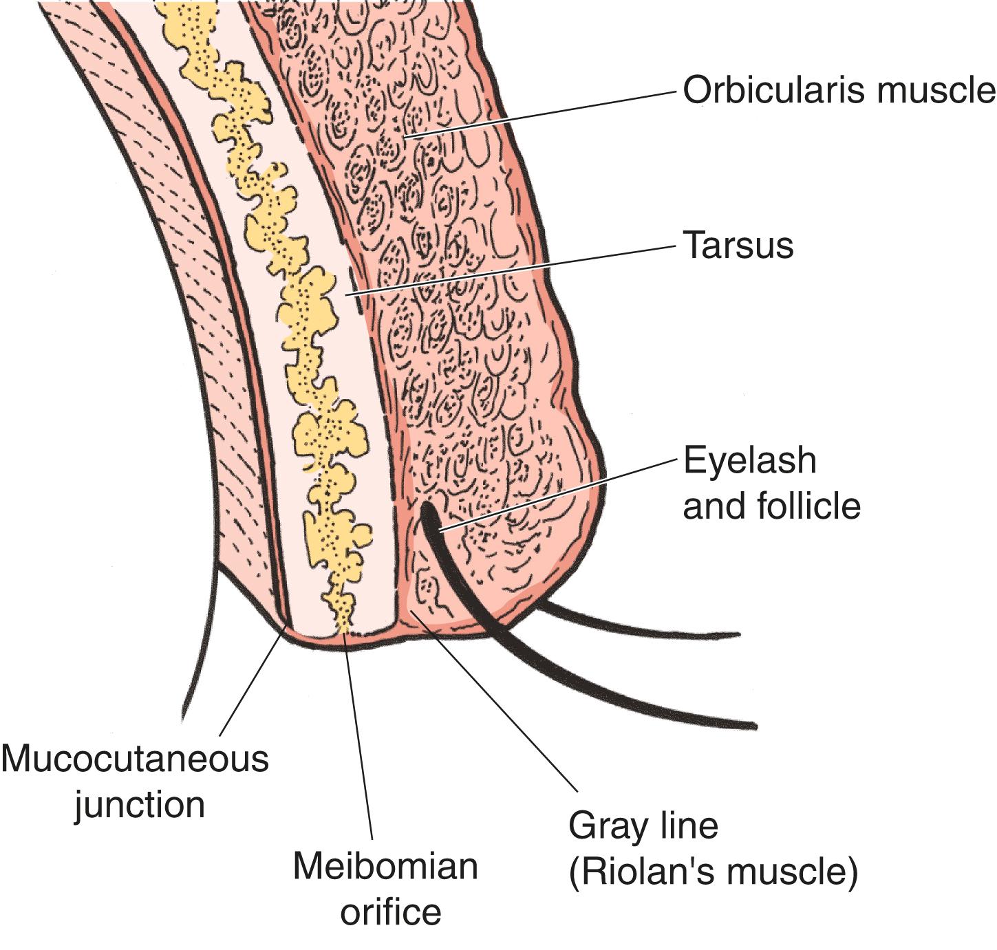 Figure 4.2, Normal eyelid margin architecture. Note the position of the gray line, meibomian glands, and mucocutaneous junction.