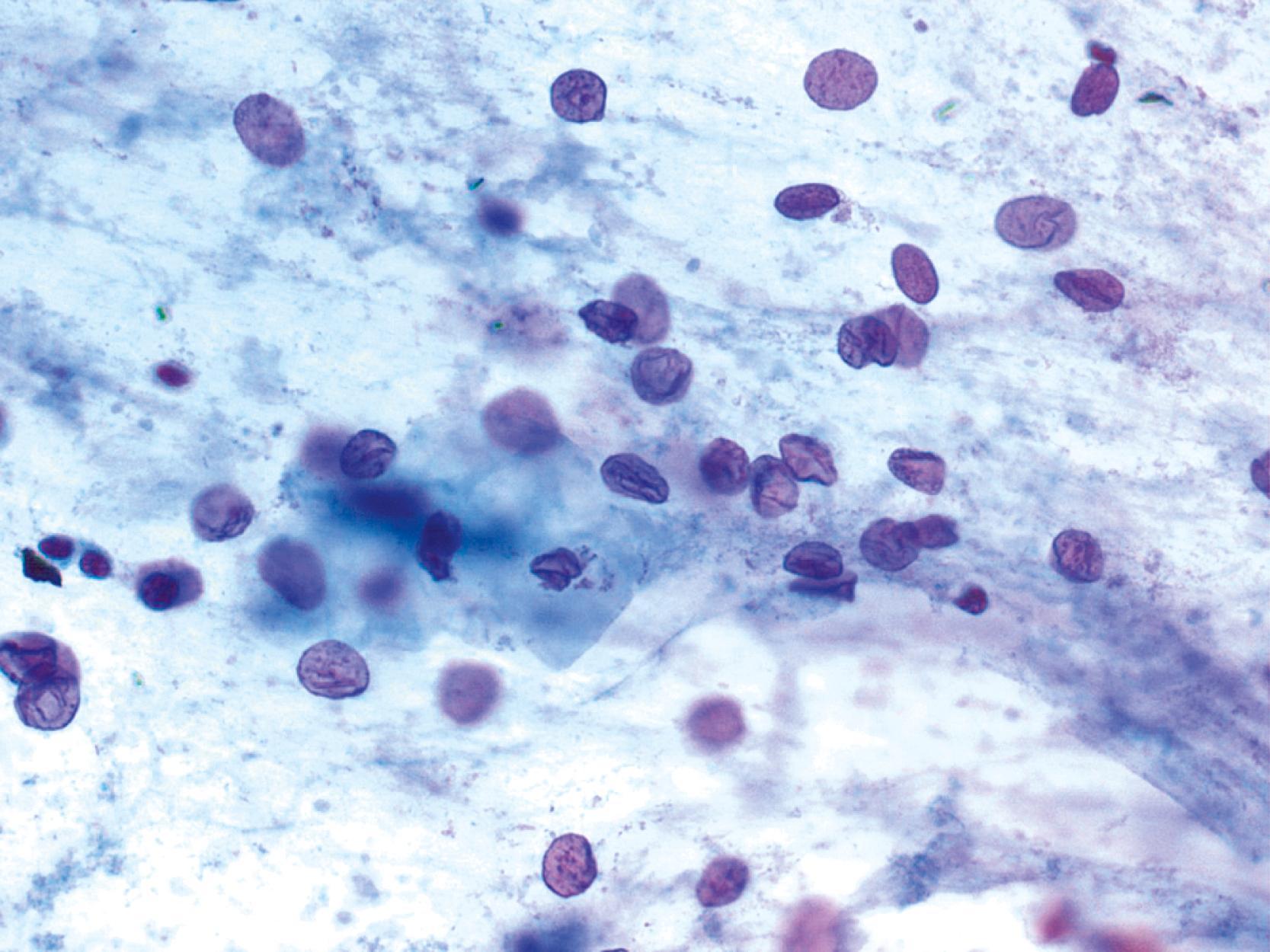 FIGURE 36.5, Gastric epithelium.