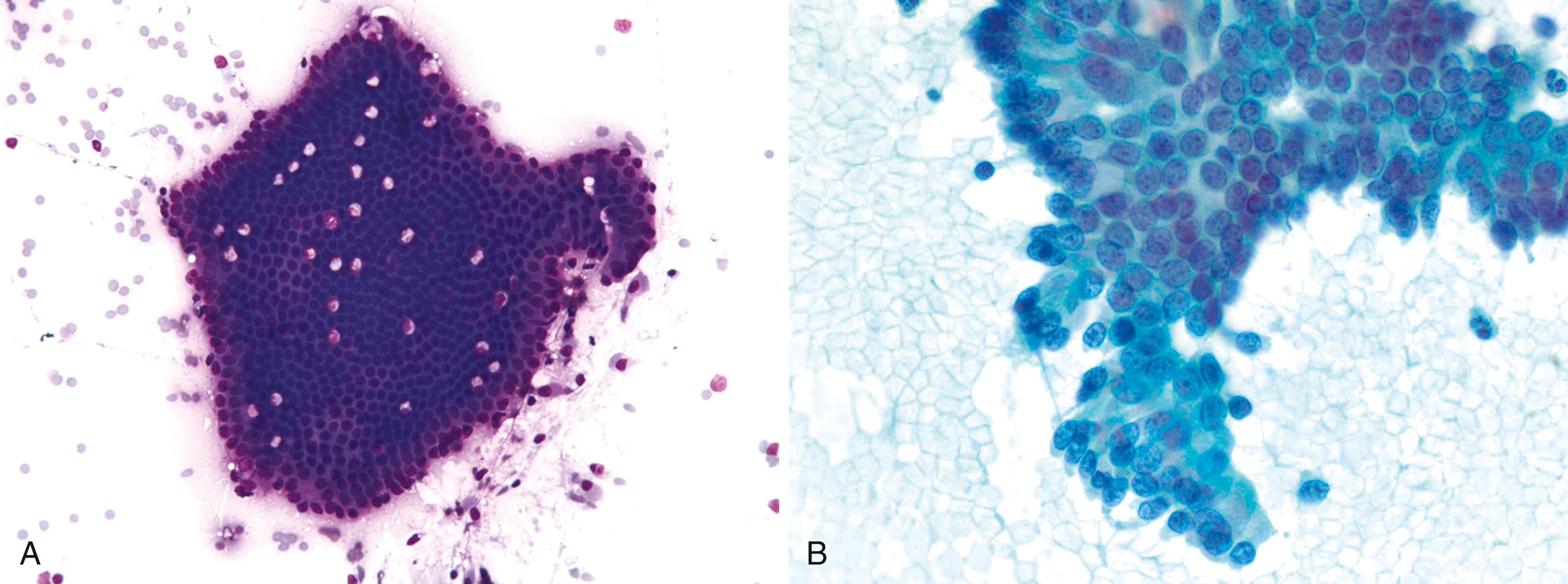 FIGURE 36.7, Duodenal epithelium.