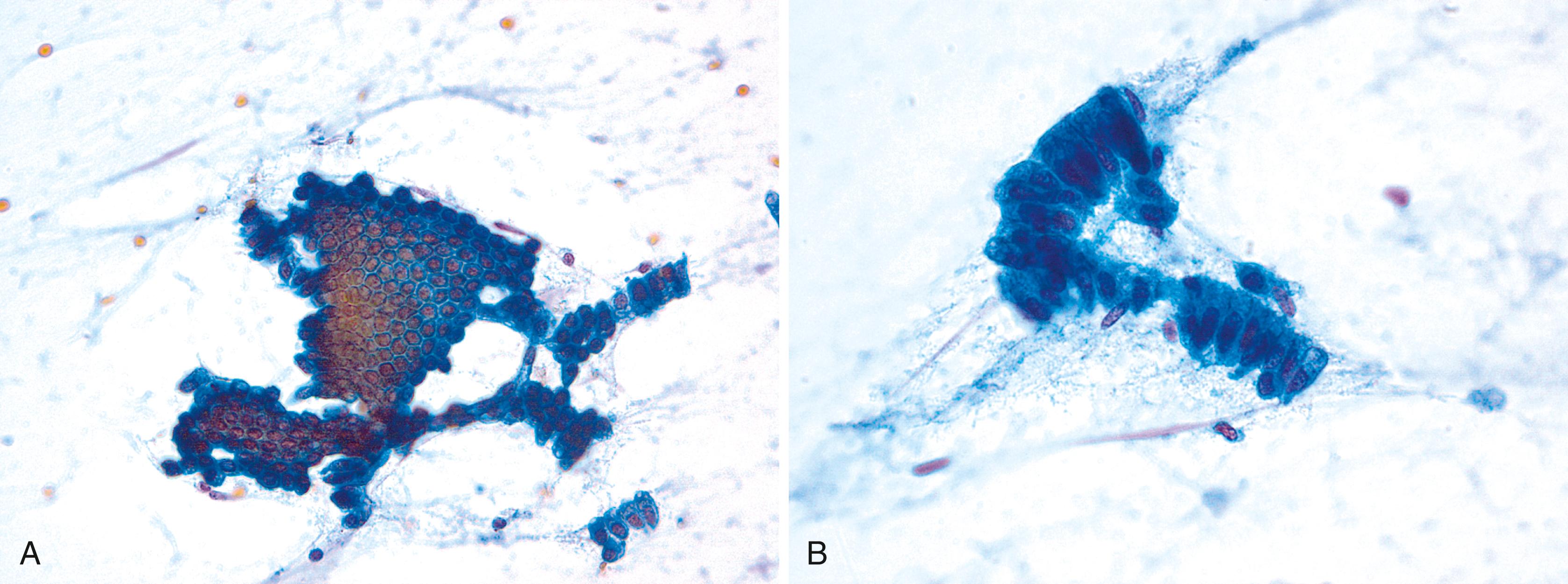 FIGURE 36.8, Normal biliary tract epithelium.