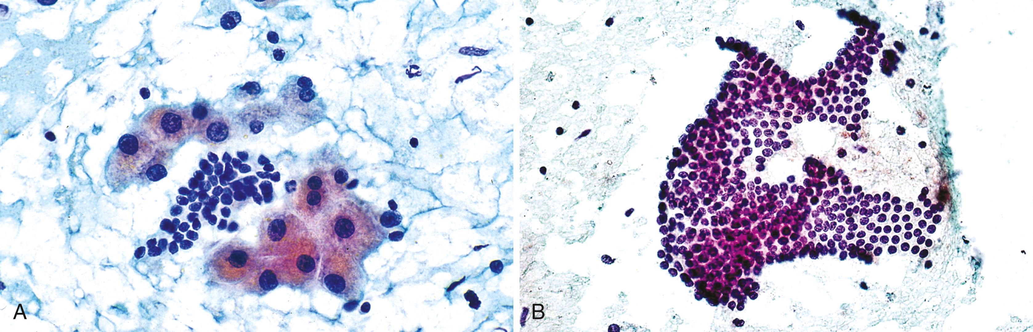 FIGURE 46.1, Normal hepatocytes and bile duct epithelium.