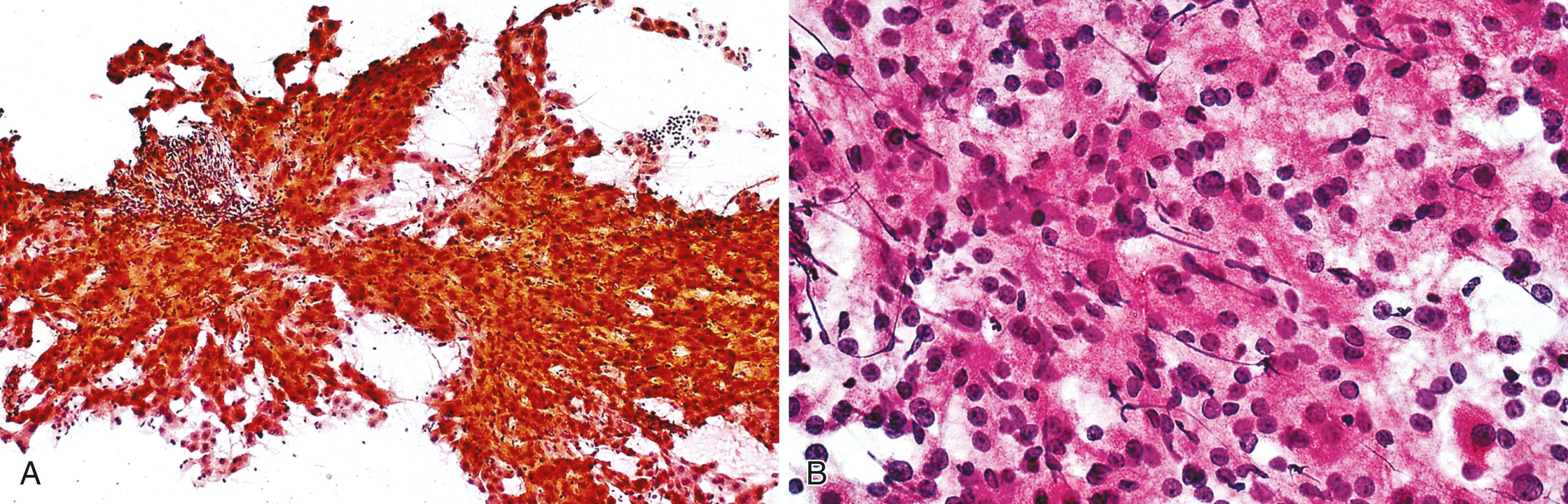 FIGURE 46.2, Normal liver parenchyma.