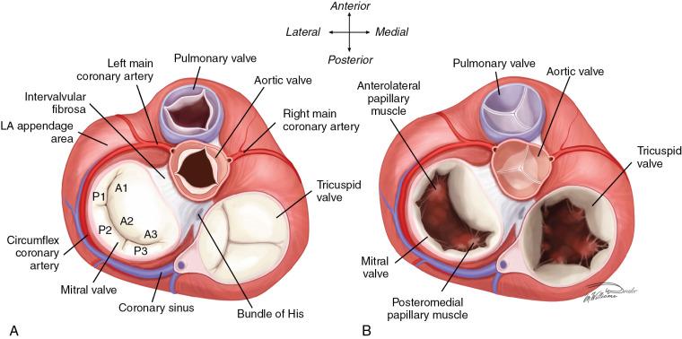 Fig. 15.2, Anatomic Relationships of the Mitral Valve.