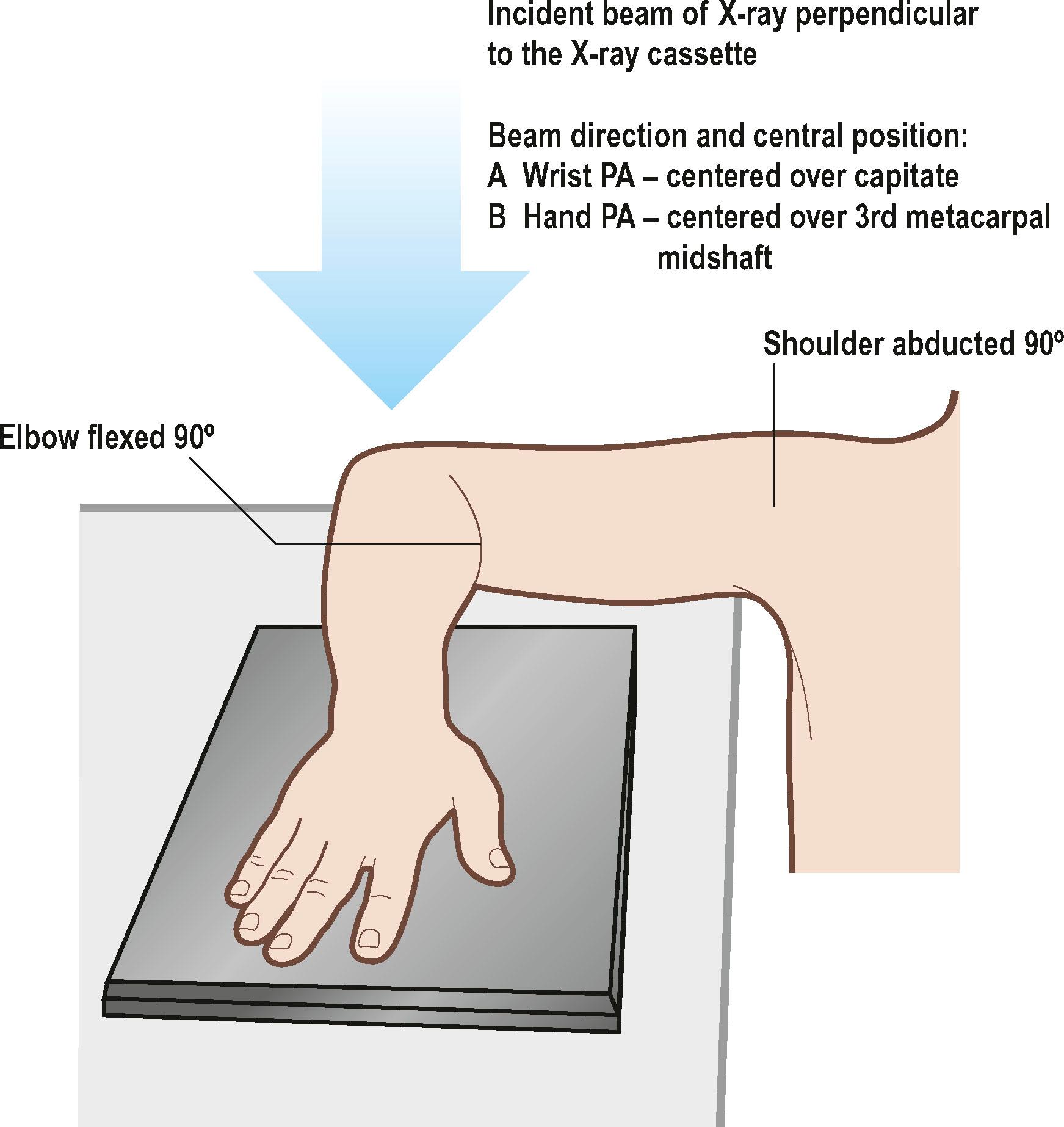 Figure 3.1, The posteroanterior (PA) radiograph of the hand and wrist is taken in the position shown. For the hand radiograph, the beam is centered over the midshaft of the third metacarpal. For the wrist radiograph, it is centered over the capitate.