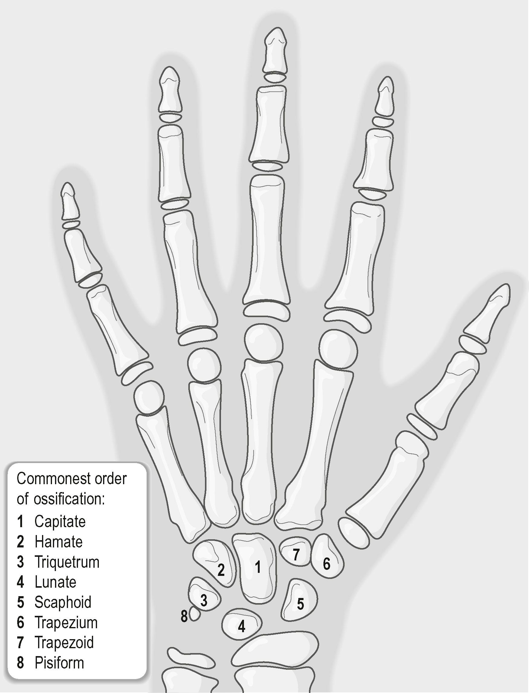 Figure 3.11, Commonest order of ossification: capitate, hamate, triquetrum, lunate, scaphoid, trapezium, trapezoid, and pisiform. Note the position of the growth plates on the proximal ends of the phalanges and first metacarpal. In the remaining ulnar four metacarpals, the growth plate is on the distal end of the bone.