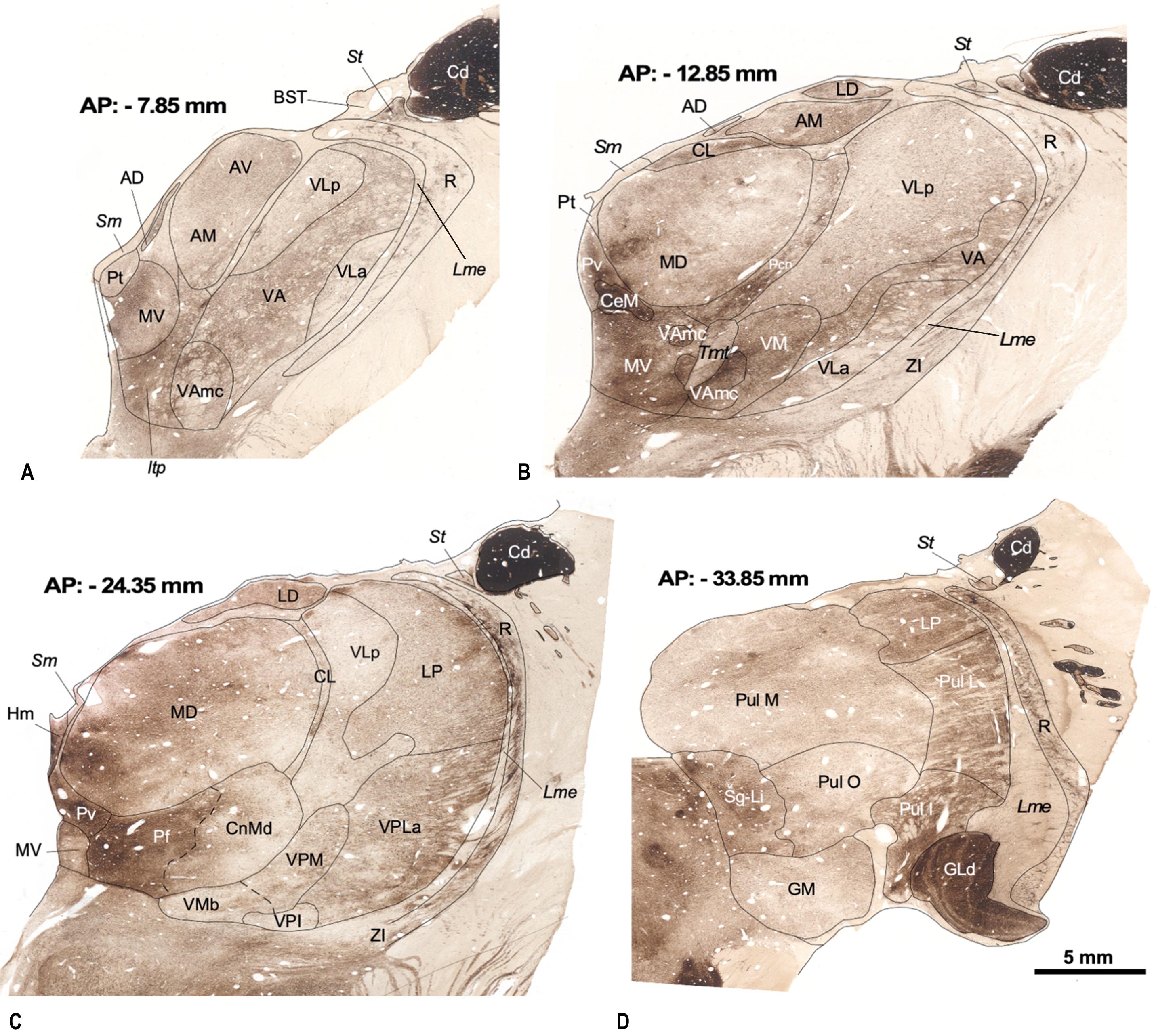 Fig. 30.3, A series of coronal sections from a human hemithalamus stained for acetylcholinesterase histochemistry. The midline is to the left. The stereotaxic anteroposterior level is given next to each section (stereotaxic brain sectioning followed Talairach and Tournoux (1988) criteria). Abbreviations: AD, anterodorsal nucleus; AM, anteromedial nucleus; AV, anteroventral nucleus; BST, bed nucleus of the stria terminalis; Cd, caudate nucleus; CeM, central medial nucleus; CL, central lateral nucleus; CnMd, centromedian nucleus; GLd, dorsal lateral geniculate nucleus; GM, medial geniculate nucleus; Hm, medial habenular nucleus; Itp, inferior thalamic peduncle; LD, lateral dorsal nucleus; Li, limitans nucleus; Lme, external medullary lamina; LP, lateral posterior nucleus; MD, mediodorsal nucleus; MV, medioventral nucleus; Pcn, paracentral nucleus; Pf, parafascicular nucleus; Pt, parataenial nucleus; Pul I, inferior pulvinar nucleus; Pul L, lateral pulvinar nucleus; Pul M, medial pulvinar nucleus; Pul O, oral pulvinar nucleus; Pv, paraventricular nucleus; R, reticular nucleus; Sg, suprageniculate nucleus; Sm, stria medullaris; St, stria terminalis; Tmt, mamillothalamic tract; VA, ventral anterior nucleus; VAmc, ventral anterior nucleus-magnocellular part; VLa, ventral lateral nucleus-anterior part; VLp, ventral lateral nucleus-posterior part; VM, ventral medial nucleus; VMb, basal ventral medial nucleus; VPI, ventral posterior inferior nucleus; VPLa, ventral posterior lateral nucleus-anterior part; VPM, ventral posterior medial nucleus; ZI, zona incerta.
