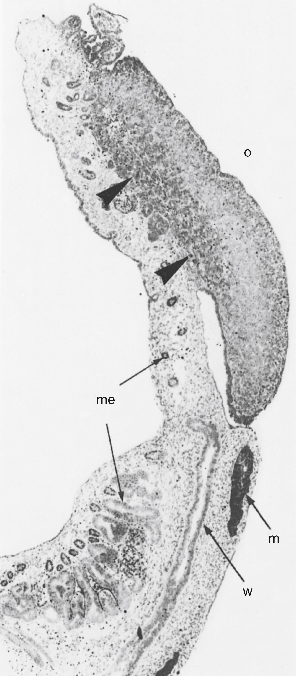 Fig. 147.1, Ovarian-mesonephric complex of an 11-week-old human fetal ovary. The mesonephric cells that invade the ovary are recognized as the dark cell mass (arrowheads) in the basal part of the ovary (o). The Wolffian duct (w), the müllerian duct (m), and mesonephric tubules (me) are seen. (Original magnification ×200.)