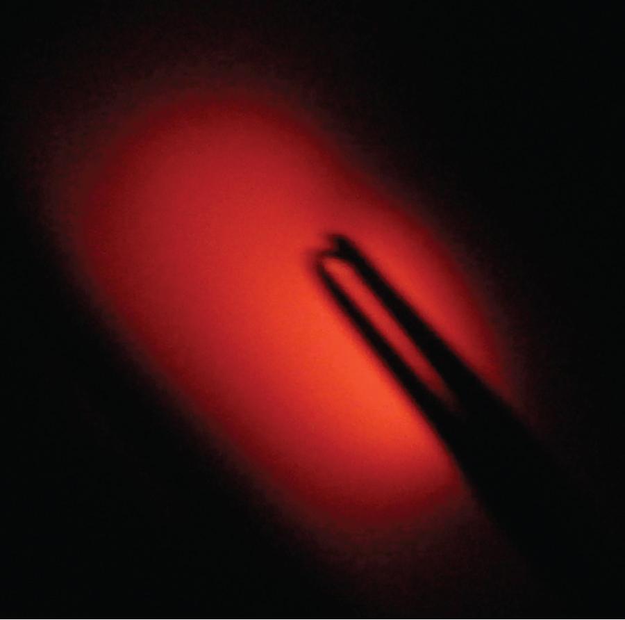 Fig. E1.24, Flexible fiber-optic bronchoscope (FFB) passed over retrograde wire, with tip of FFB at wire insertion site at the cricothyroid membrane, with transillumination of light from the FFB.