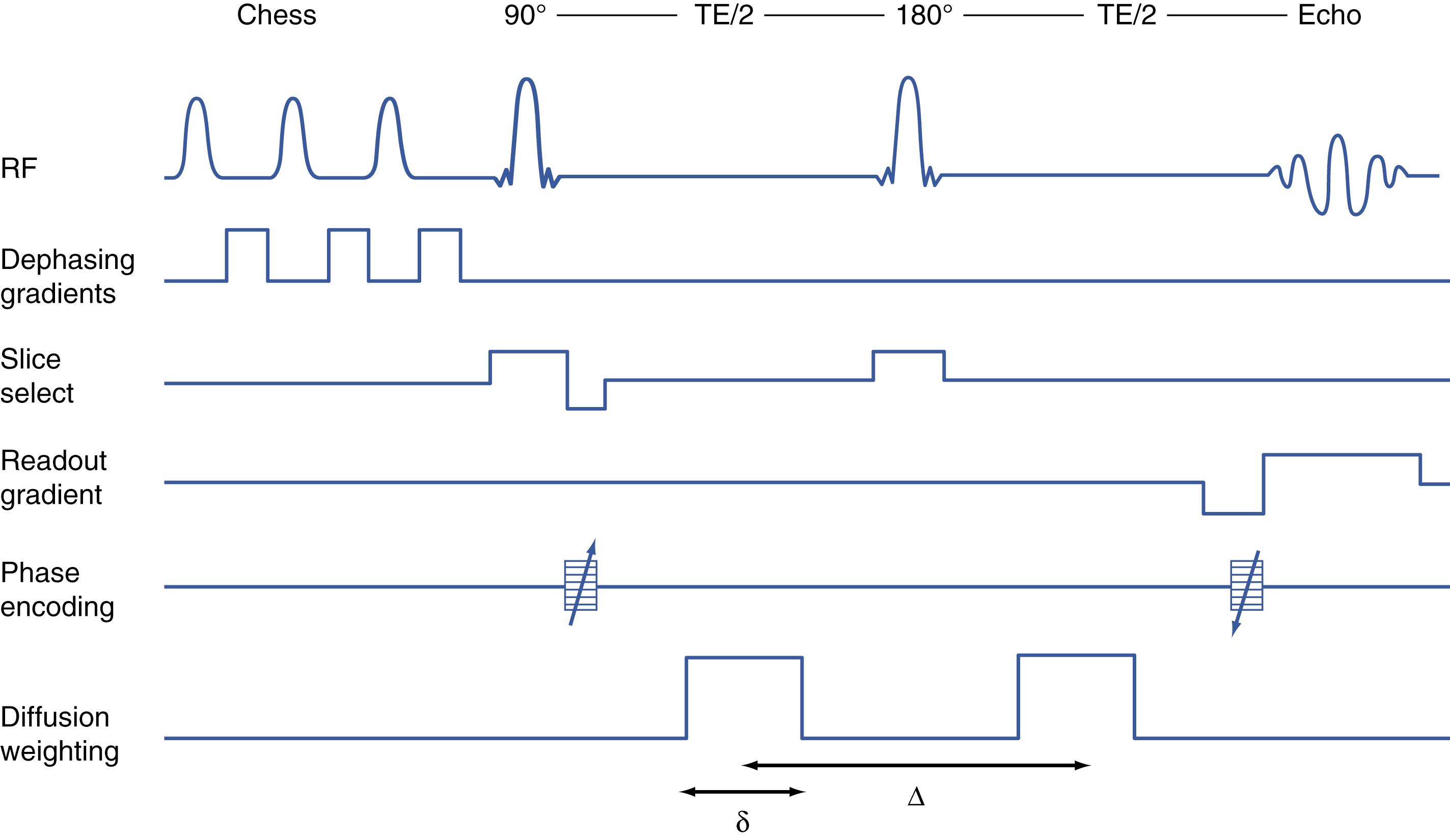 Figure 14.3, Radiofrequency (RF) and gradient pulse timing of the spin echo sequence modified to incorporate fat suppression and diffusion weighting.