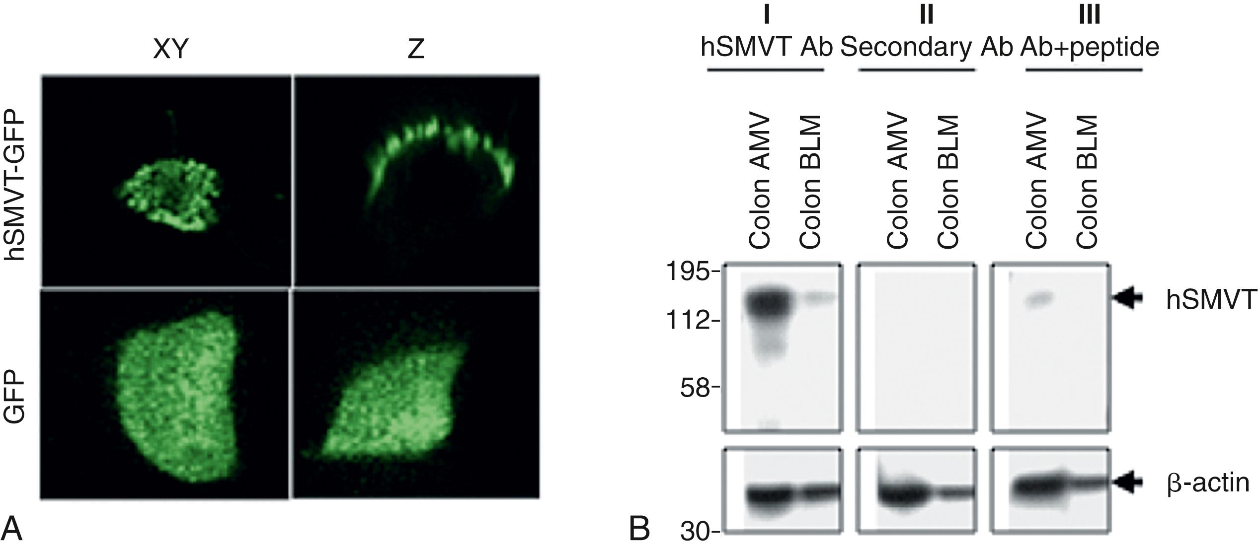 Fig. 103.2, Cellular distribution of human sodium-dependent multivitamin transporter protein.