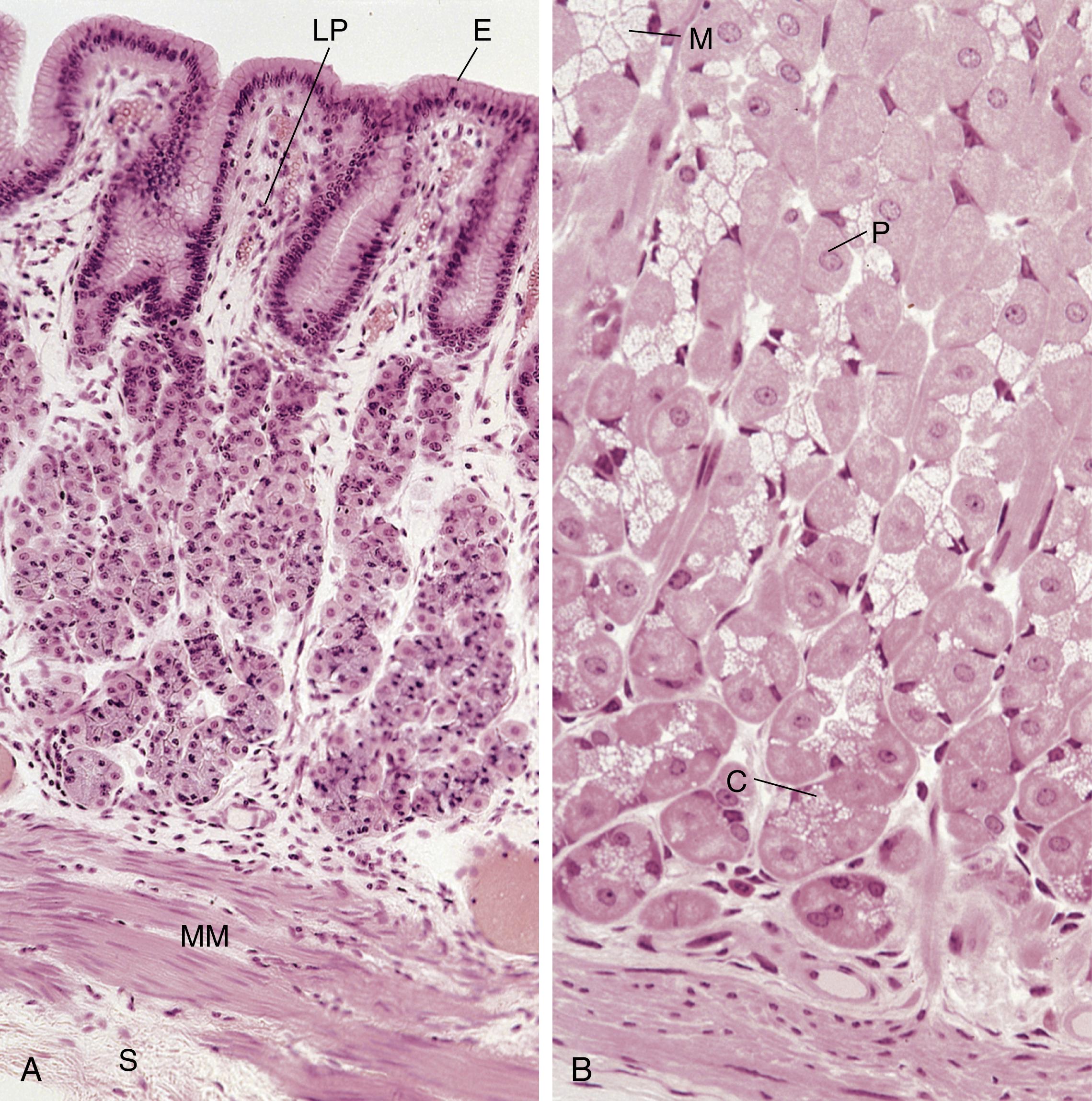 Fig. 17.5, (A) Photomicrograph of the mucosa of the fundic stomach. The mucosa is composed of the simple columnar epithelium (E), the connective tissue lamina propria (LP), and the muscularis mucosae (MM). A little section of the submucosa (S) is evident at the bottom left-hand corner of the photomicrograph (×132). (B) Photomicrograph of fundic glands. Note that the glands are very tightly packed, and much of the connective tissue is compressed into thin wafers occupied by capillaries (×270). C, Chief cell; M, mucous neck cell; P, parietal cell.
